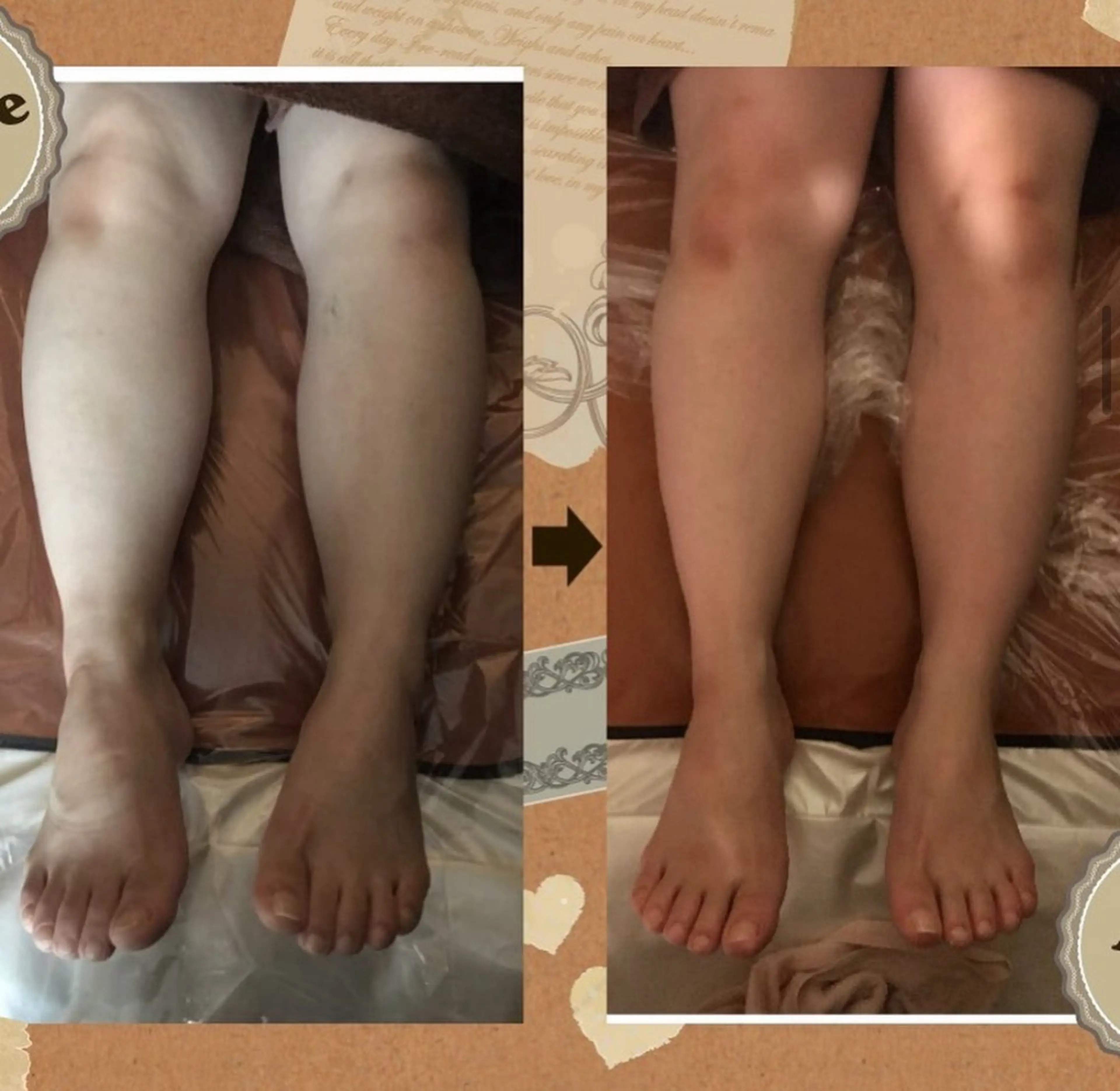 エステ リラク 小顔コルギ＆よもぎ蒸しサロンLINKA所属・小顔＆美肌 サロンLINKAのエステ・リラクイメージ