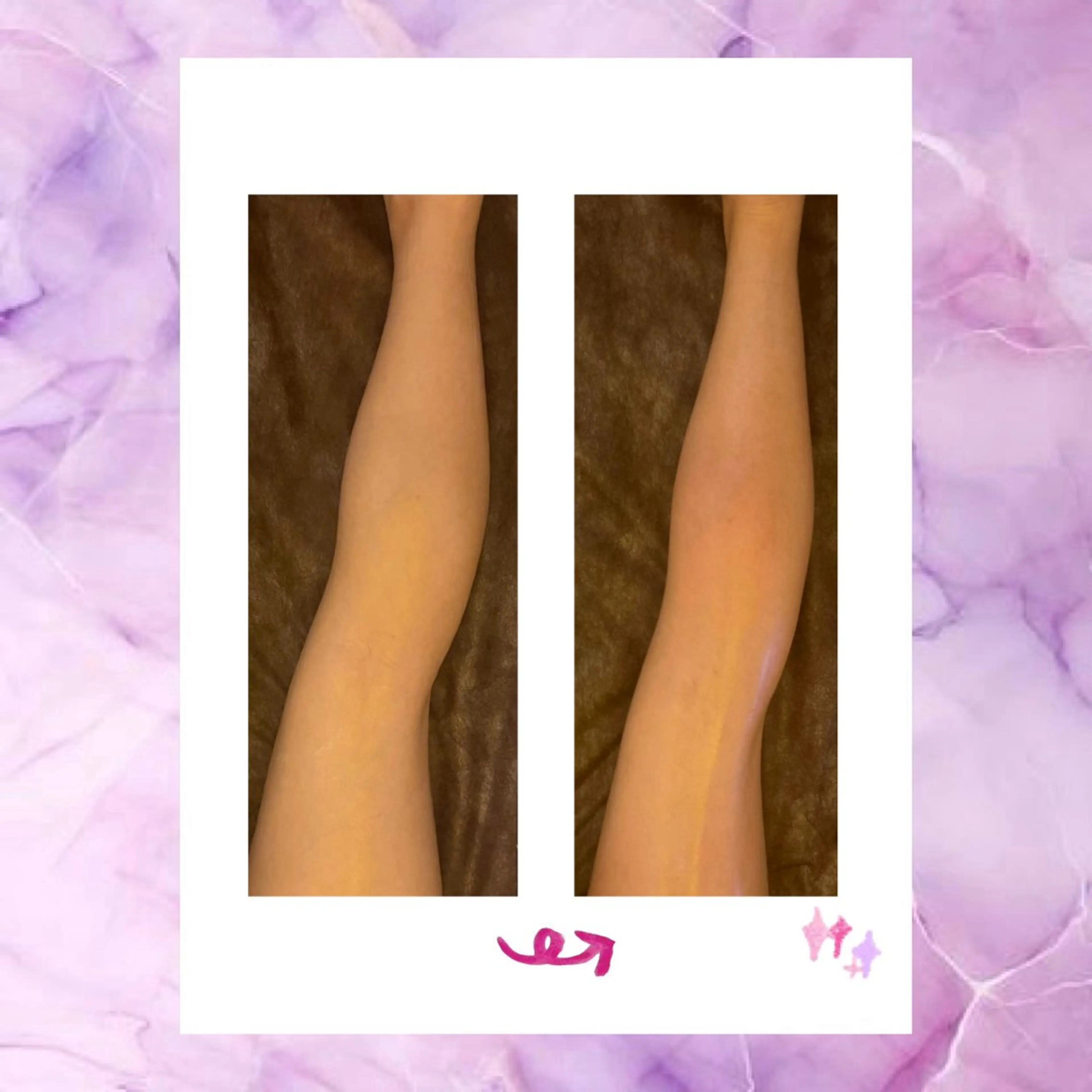 ☆痩身/小顔☆ 結果出します☆のエステ・リラクイメージ