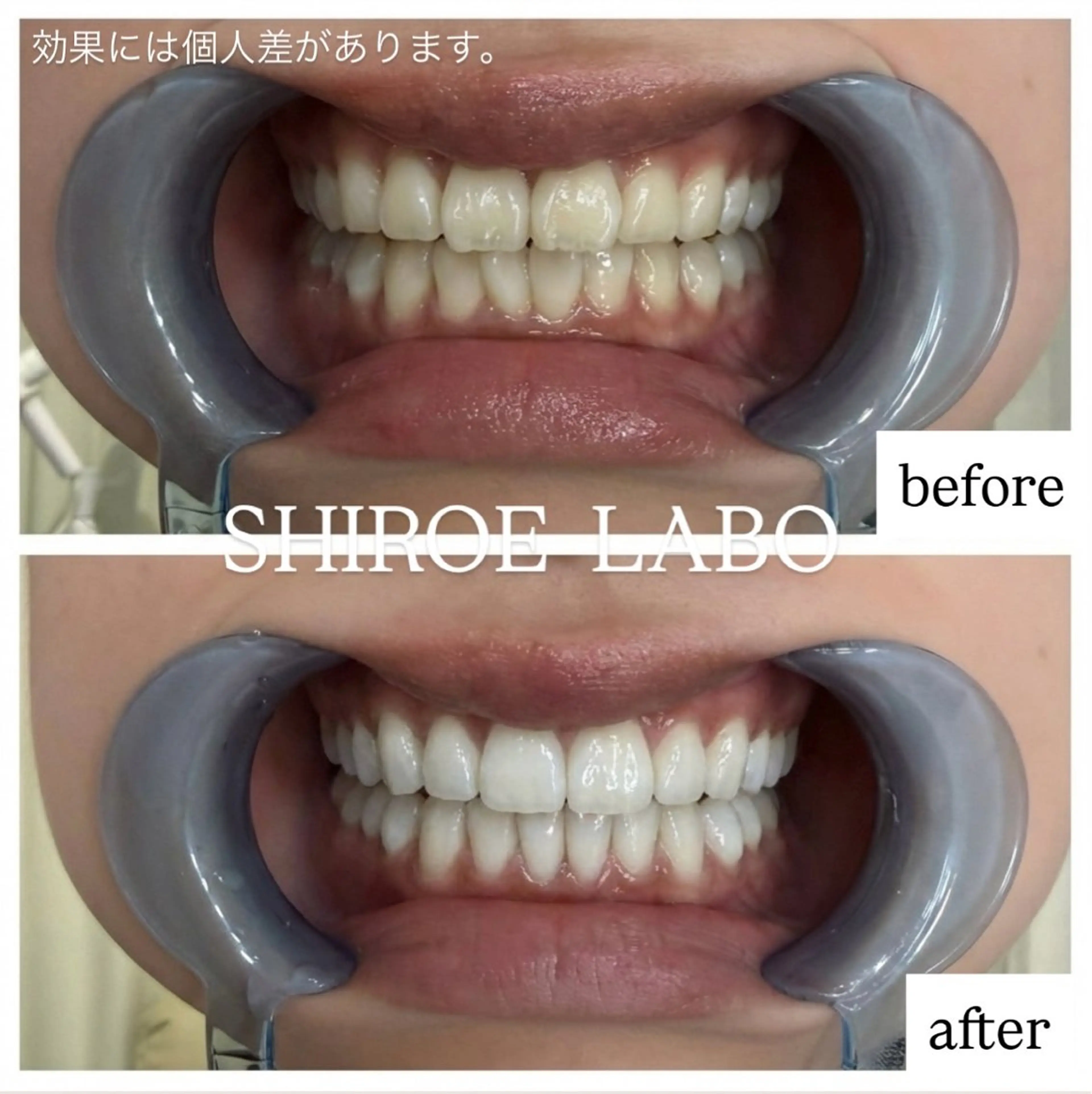 ミニモ限定価格‼️15分照射¥1,680の写真