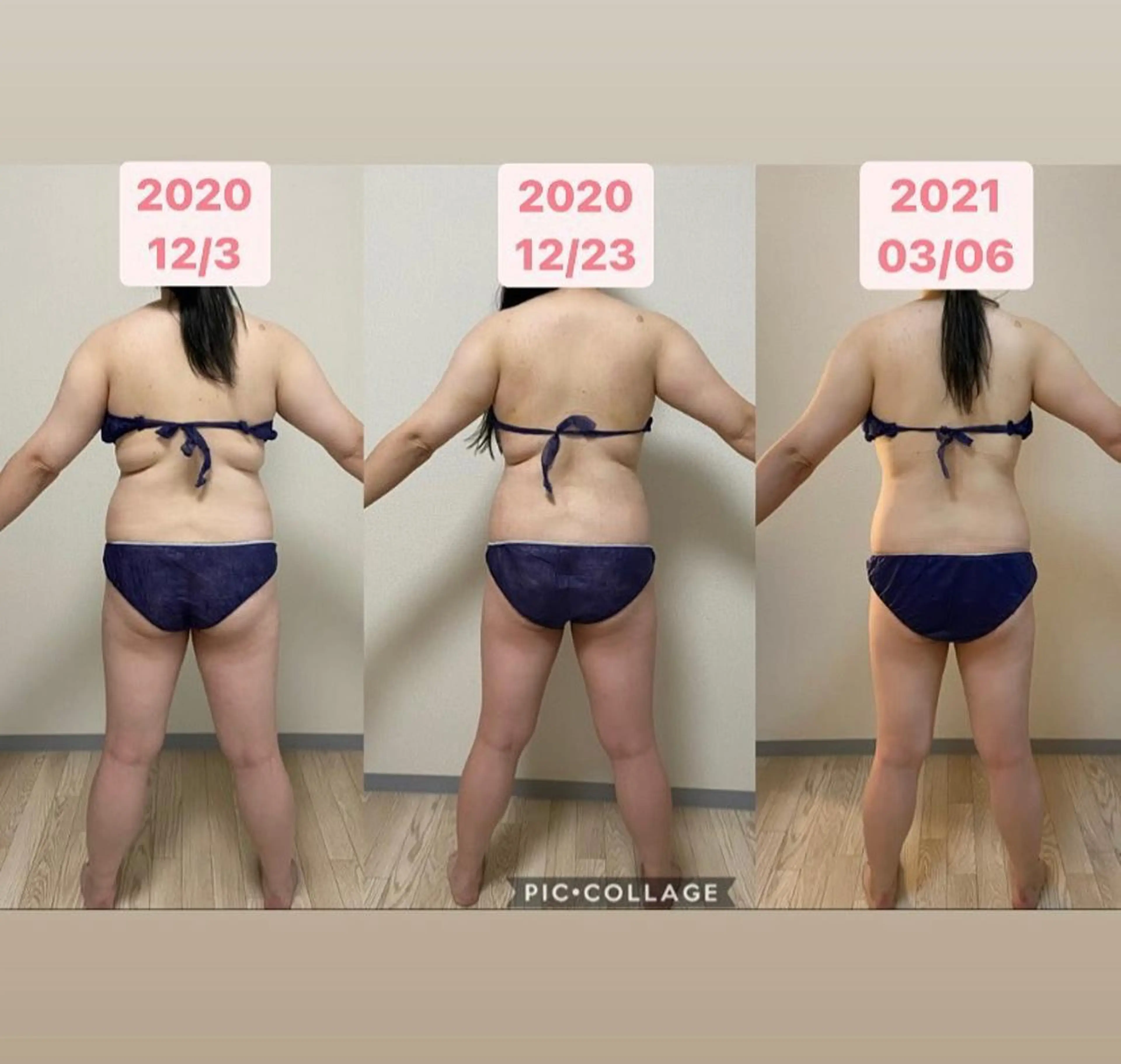 《ご新規様価格》 WINBACKラジオ波全身orお好きな部位【90分】痩身むくみセルライトケアにの写真