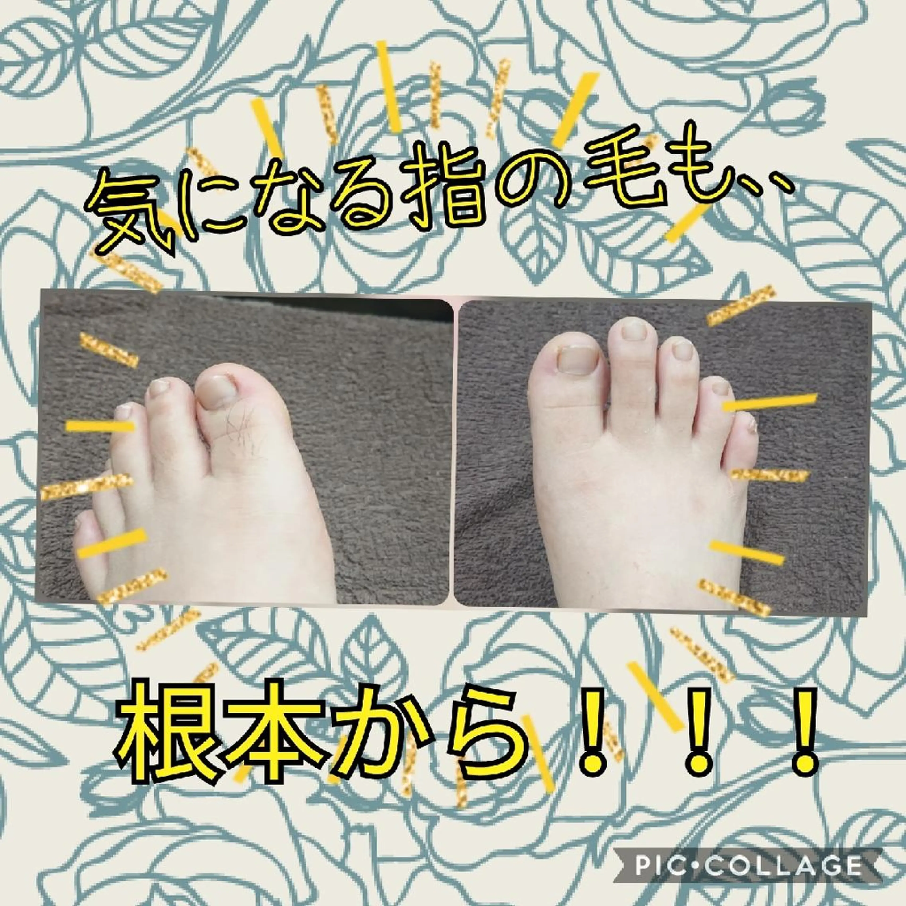 脱毛 リラクゼーション ふわりのエステ・リラクイメージ