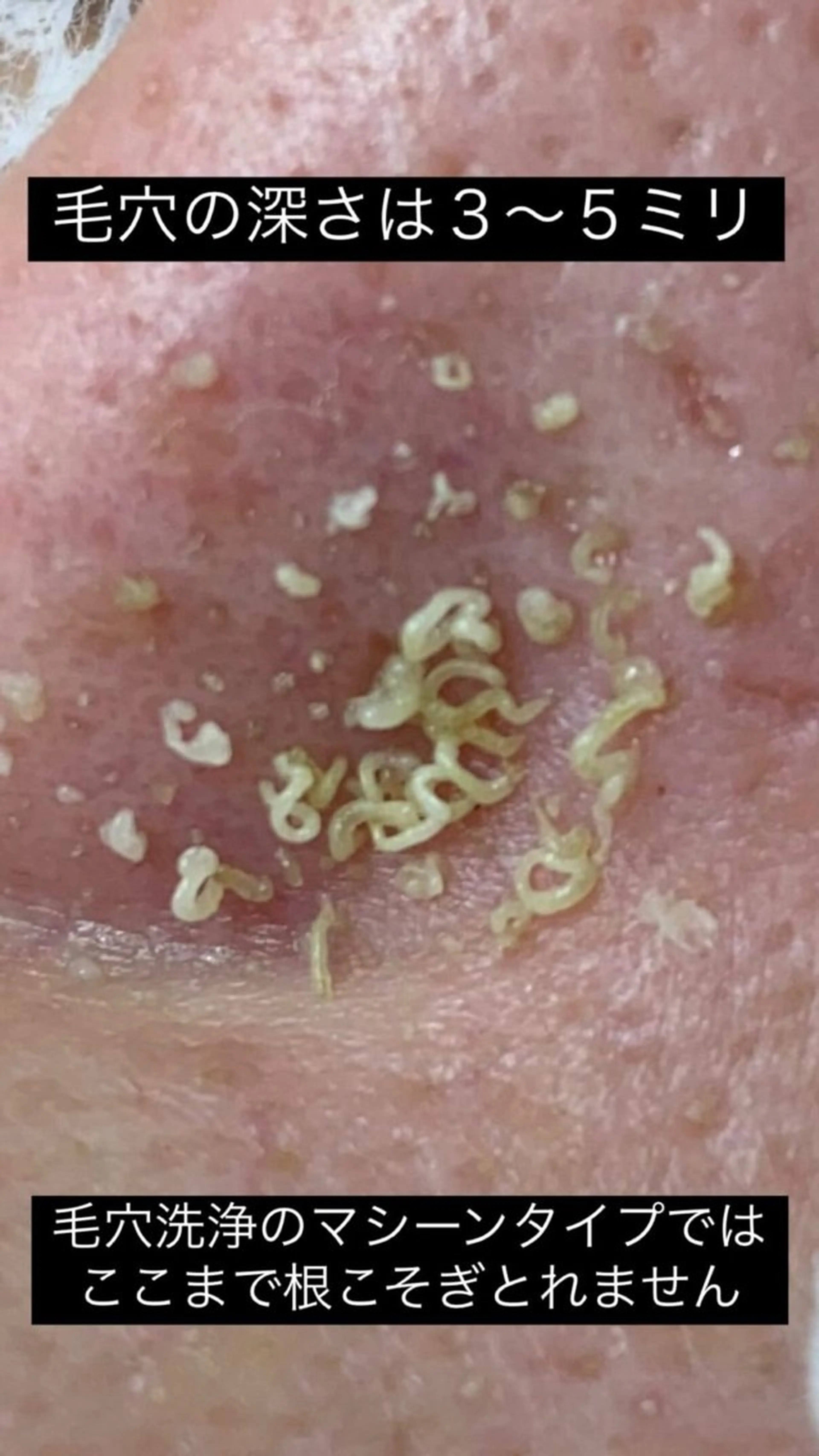 エステ akasha所属・渡部 ゆみのエステ・リラクイメージ