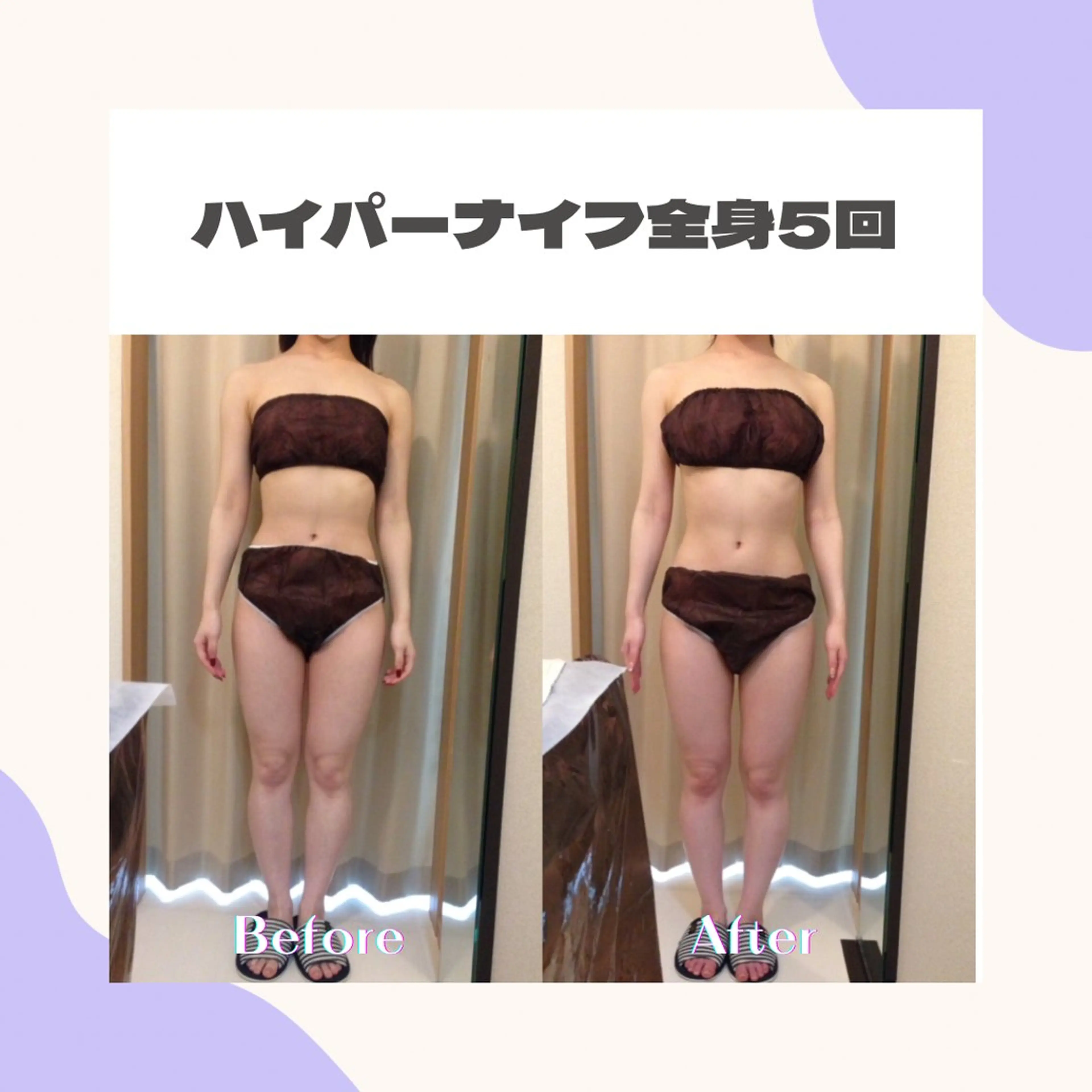 人気No2【代謝が上がる&脂肪燃やす&引き締め】全身まるごと★ハイパーナイフ90分の写真