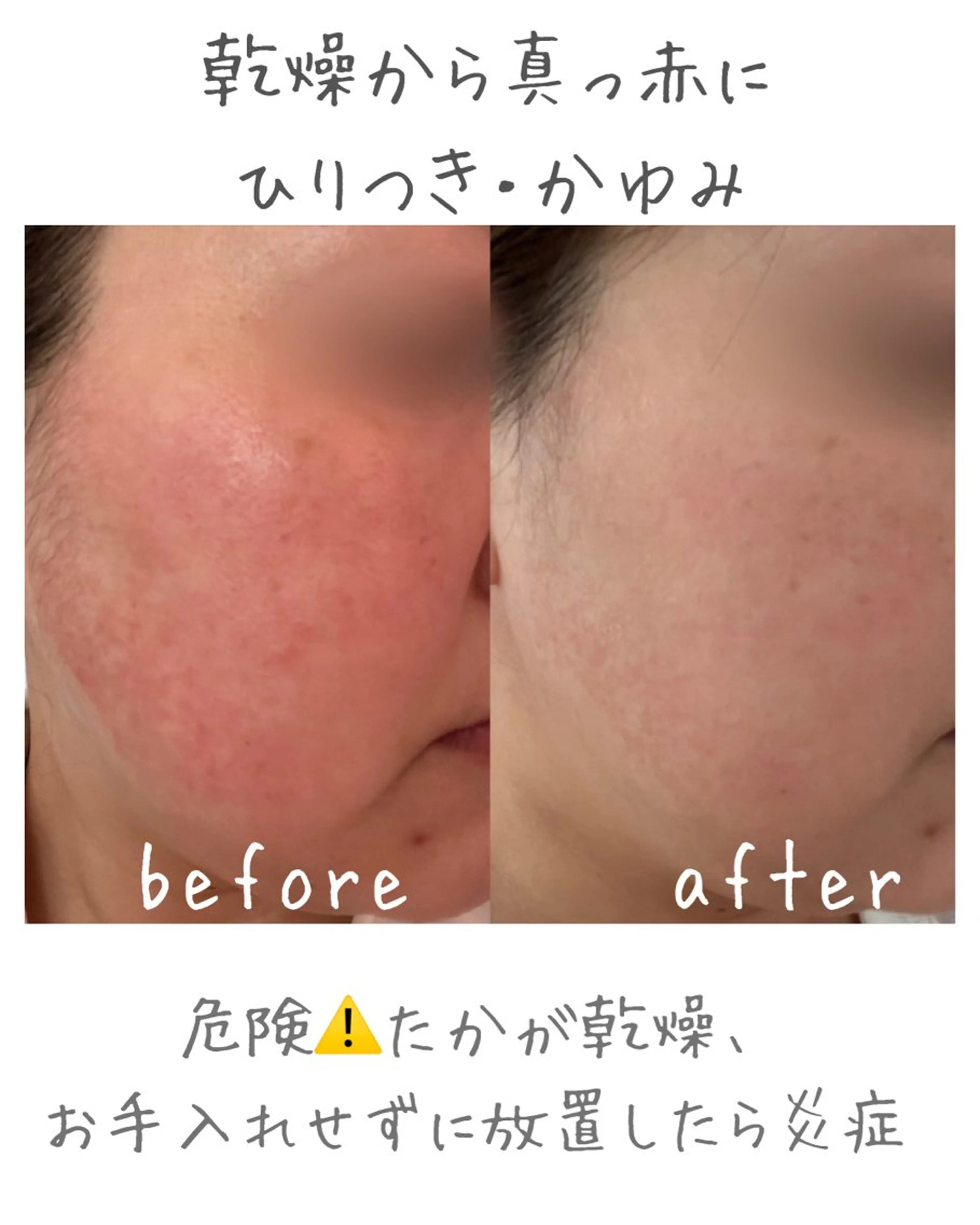 エステ ｍｉkｉ 東根の肌質改善サロンのエステ・リラクイメージ