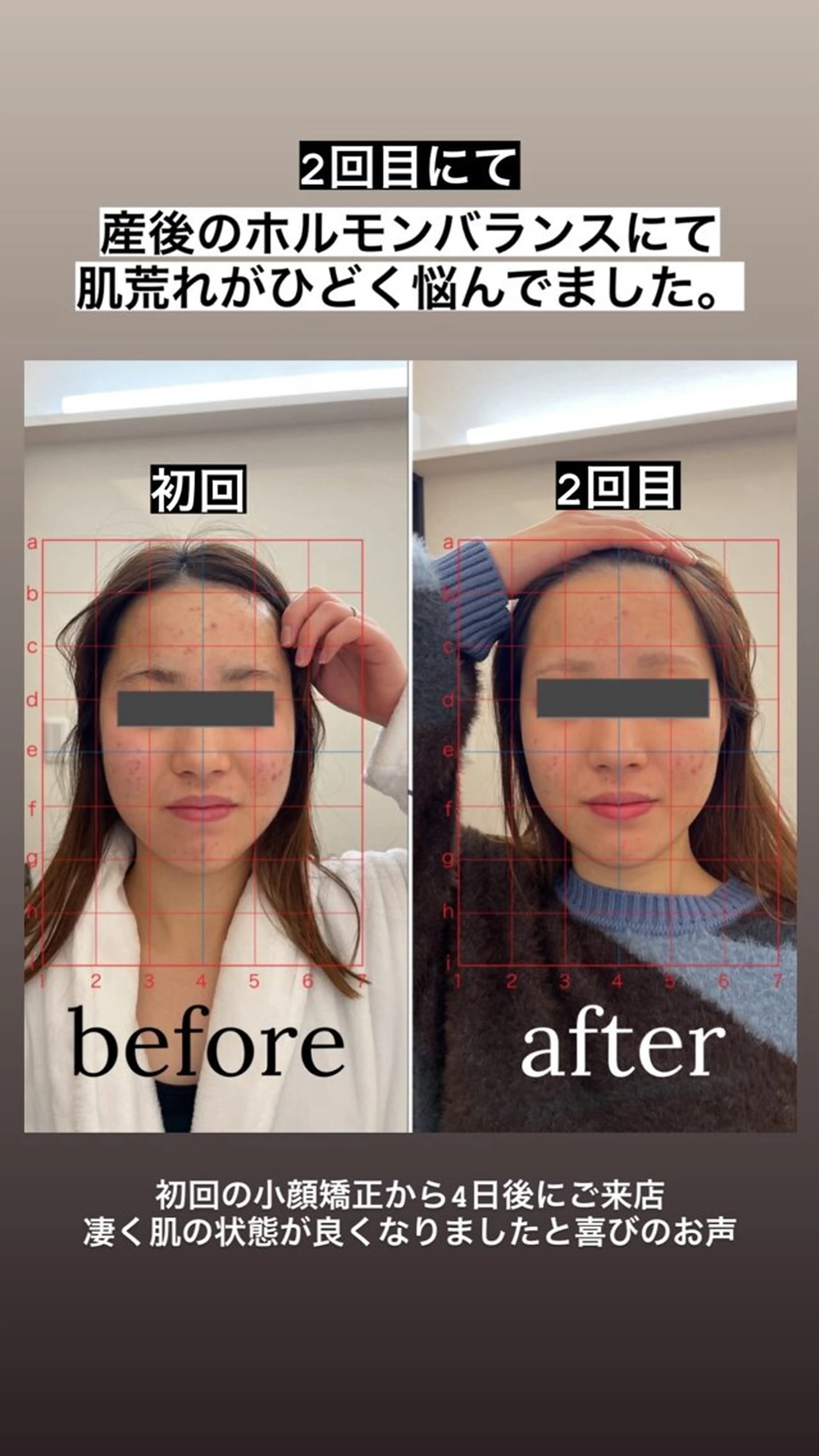 【福岡市西区 エステ】 GRANVIR(グランヴィール)所属・GRANVIR グランヴィールのエステ・リラクイメージ