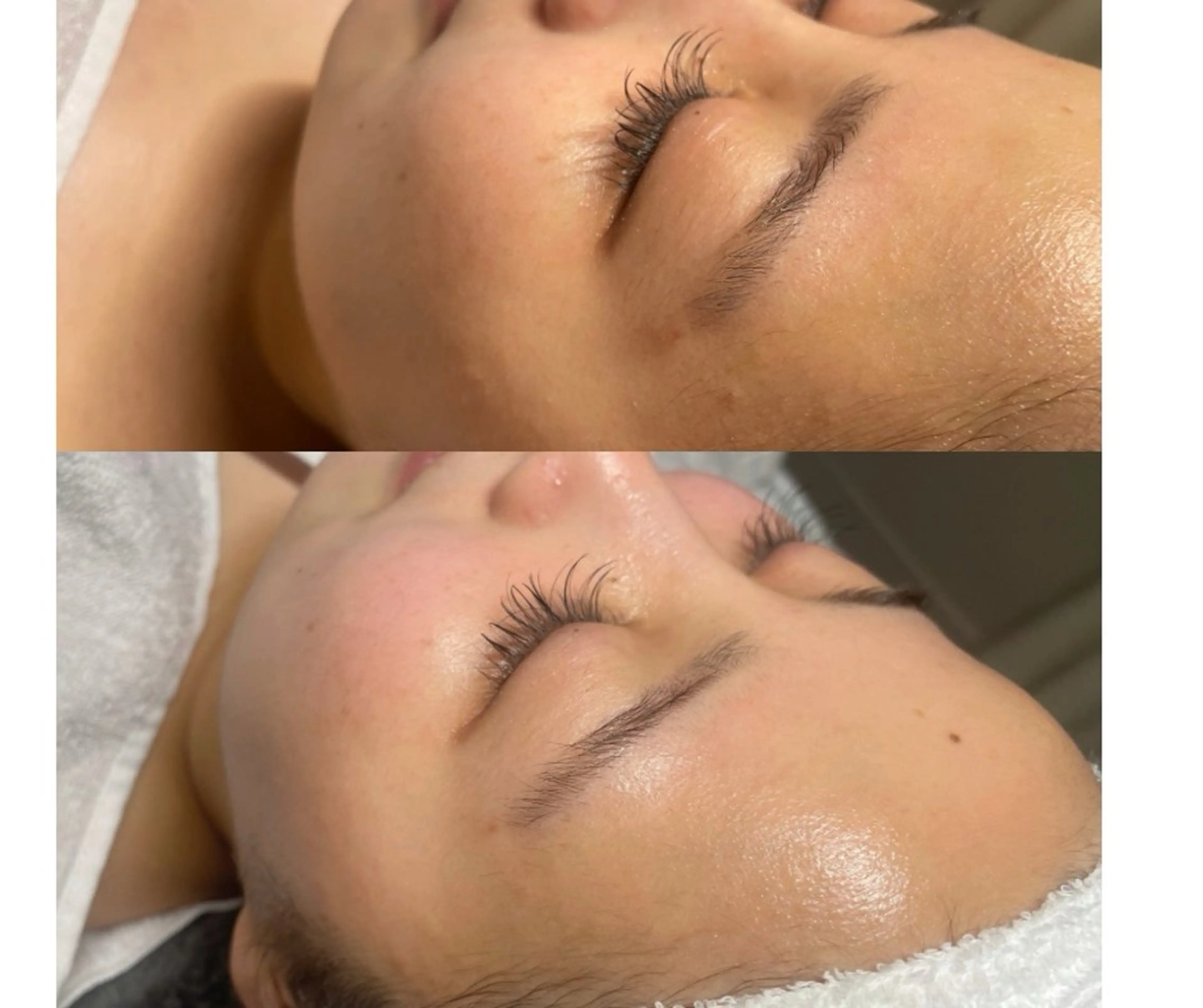 小顔/リンパ/マッサージL.sana所属・小顔/フェイシャル L.sanaのエステ・リラクイメージ