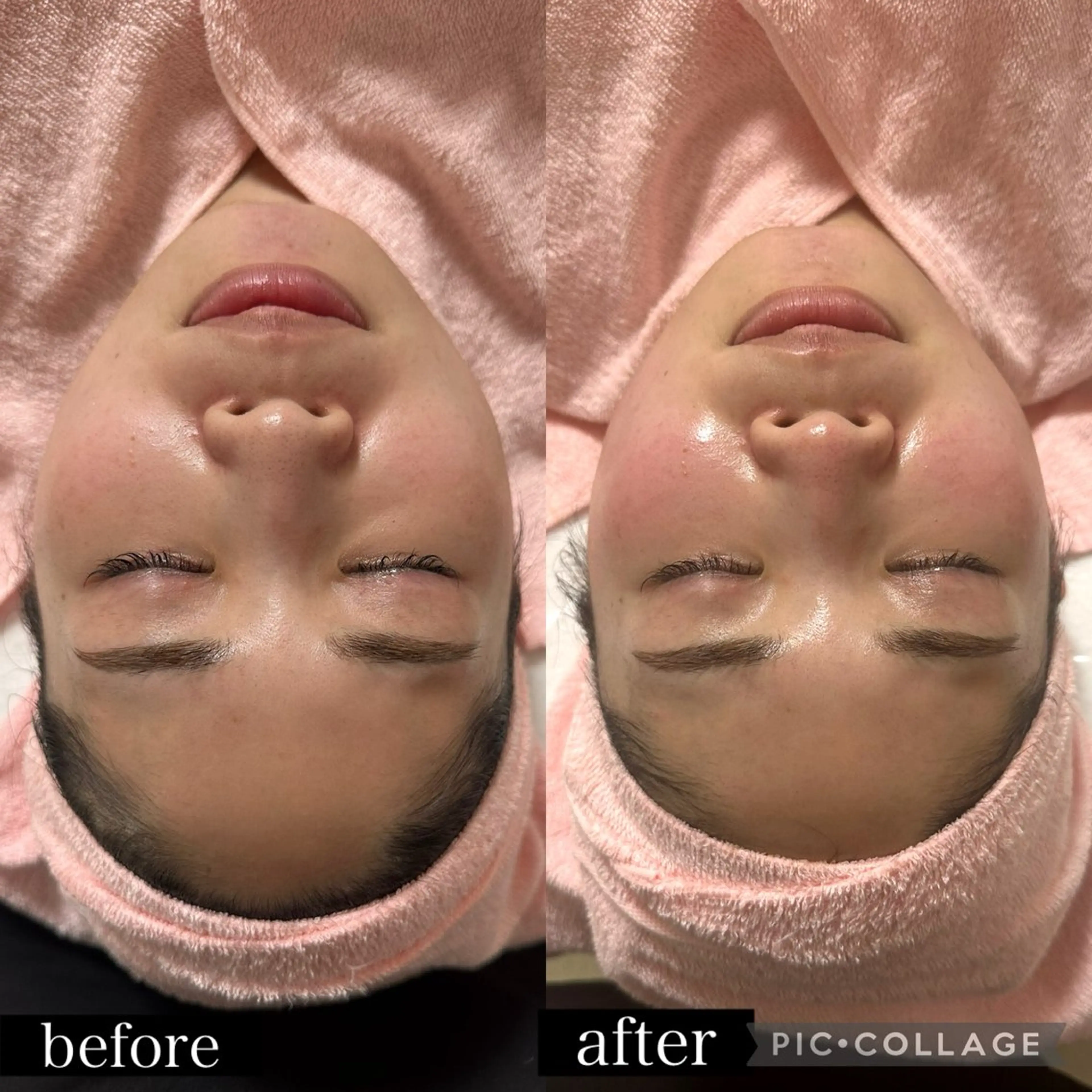 当店人気No. 1！老化に逆らう◎デコルテ背中マッサージ込み⭐️【小顔プラズマ＋韓国艶肌フェイシャル】の写真