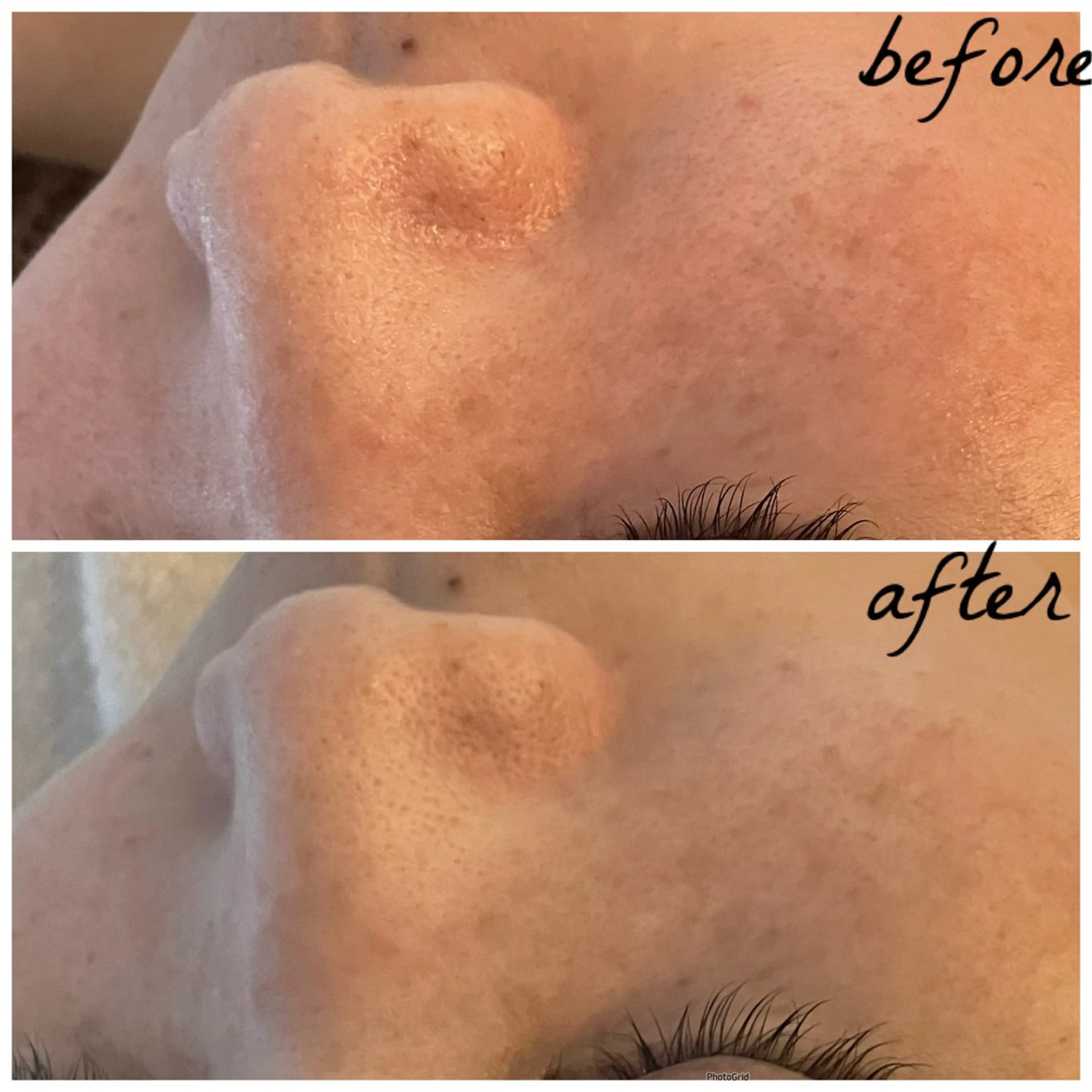 メンズ エステ メナード岐阜茜部 杉浦のエステ・リラクイメージ