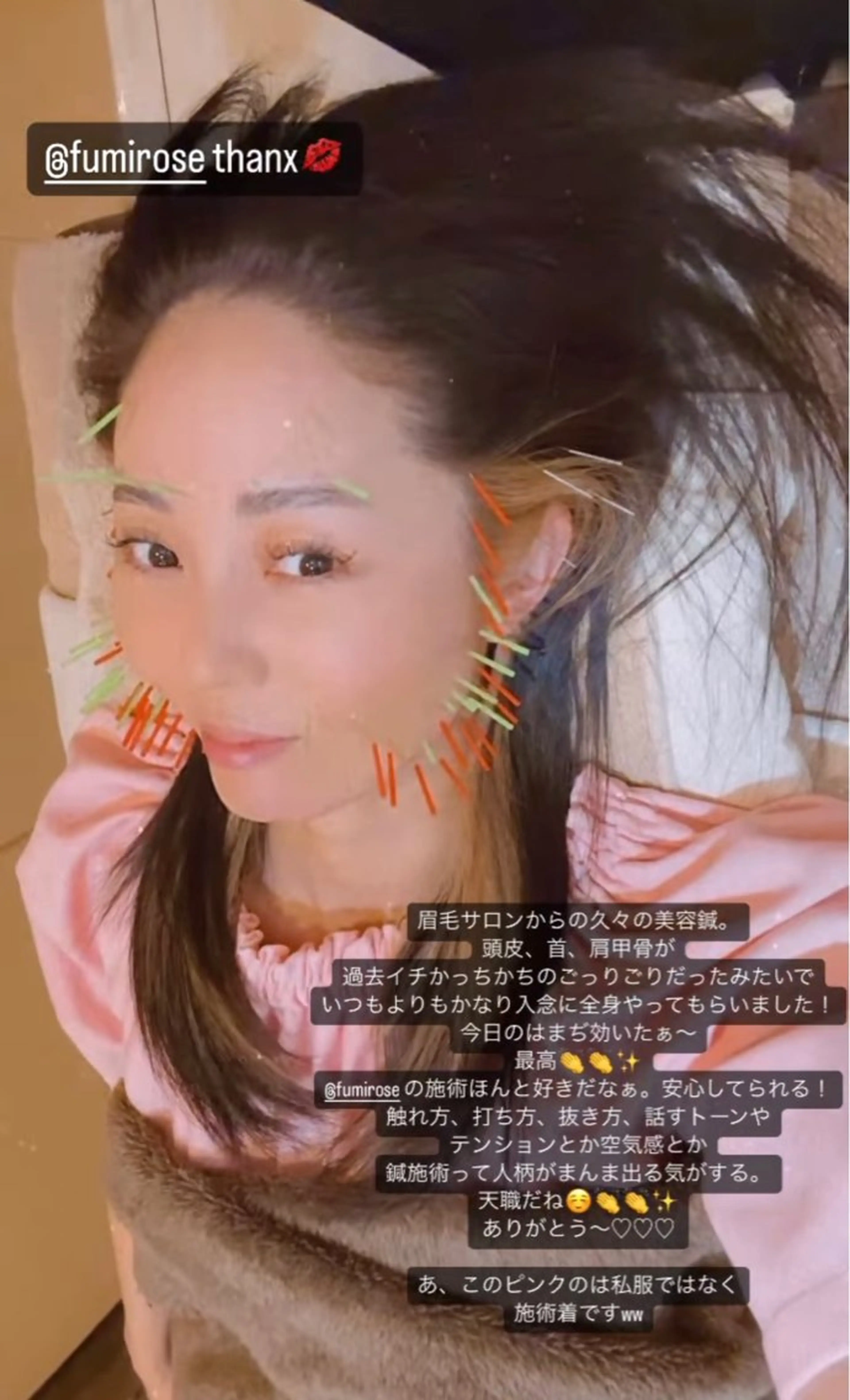 THE  ROOTS所属・美容鍼♡小顔矯正♡ fumikaのエステ・リラクイメージ