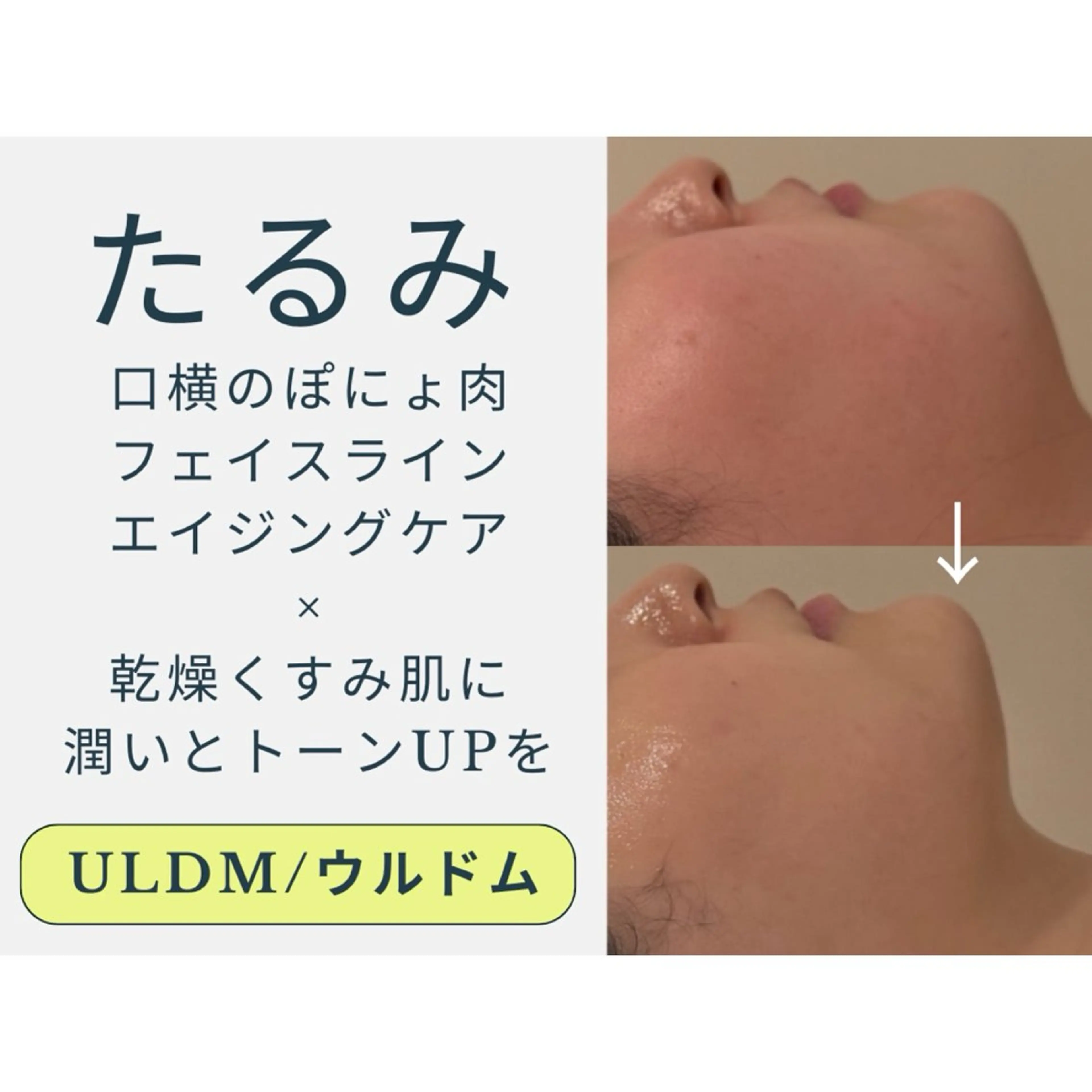 swan(スワン) 韓国肌管理 南堀江のエステ・リラクイメージ