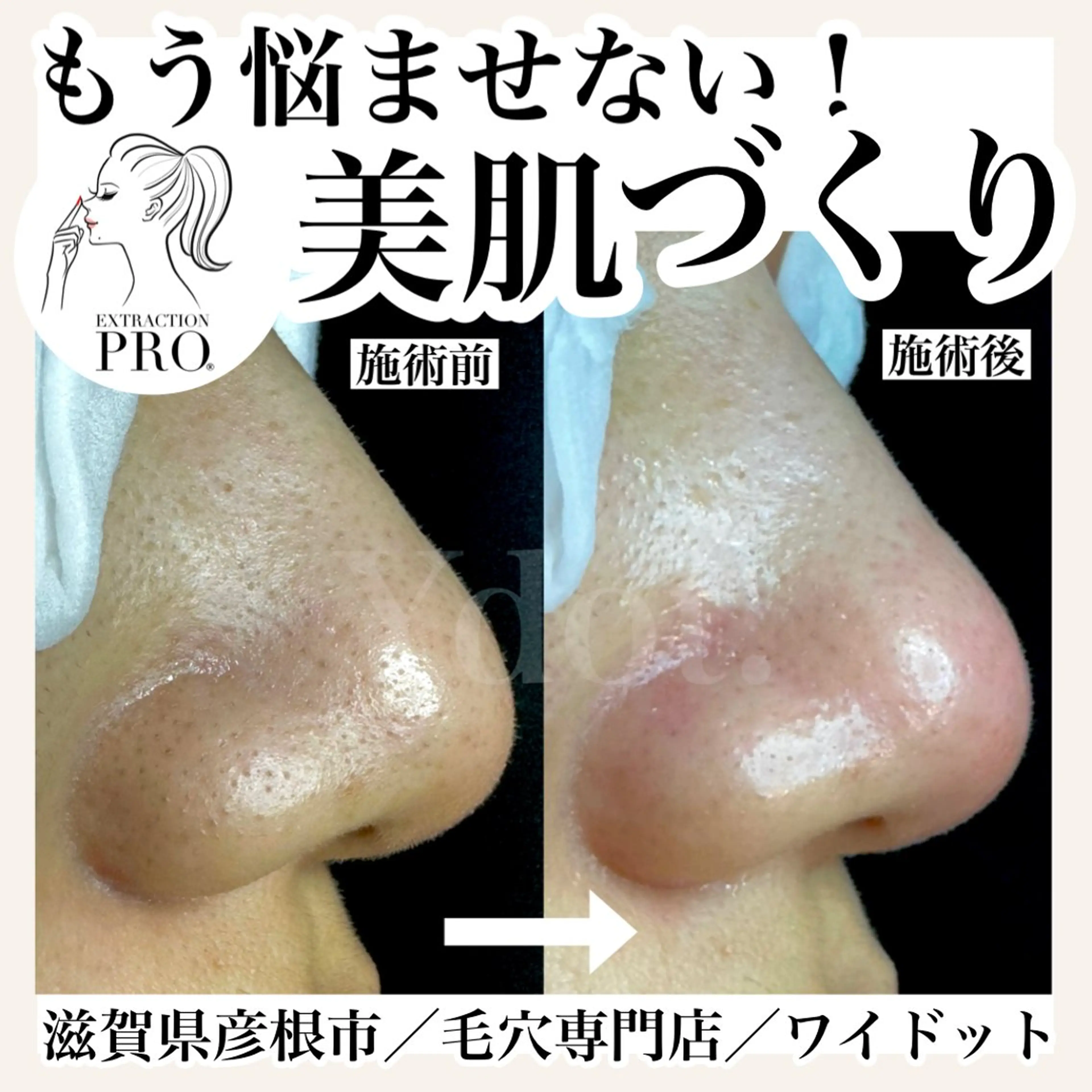 エステ Ydot. 池内 友架のエステ・リラクイメージ