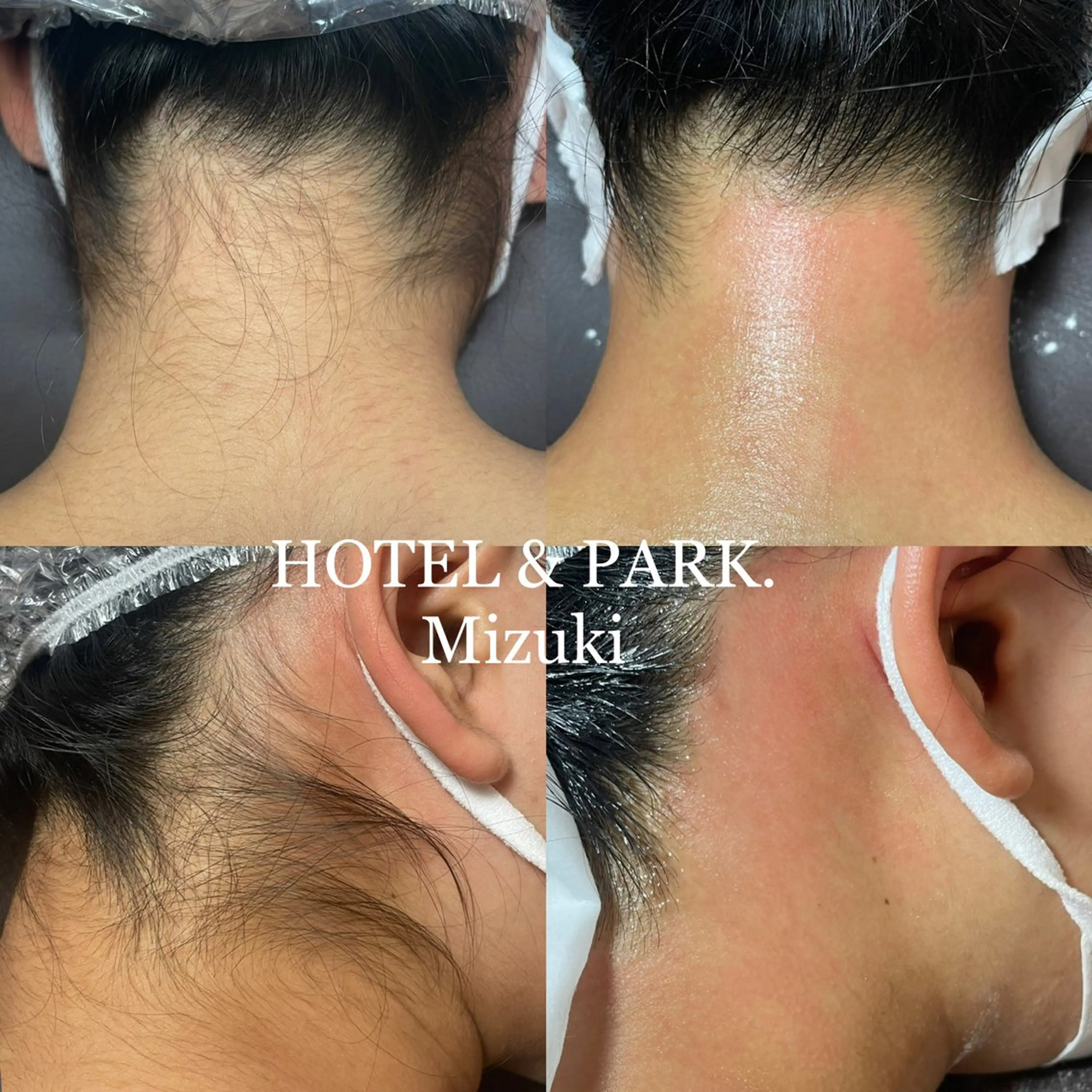 脱毛 HOTEL&PARK . ワックス脱毛のエステ・リラクイメージ