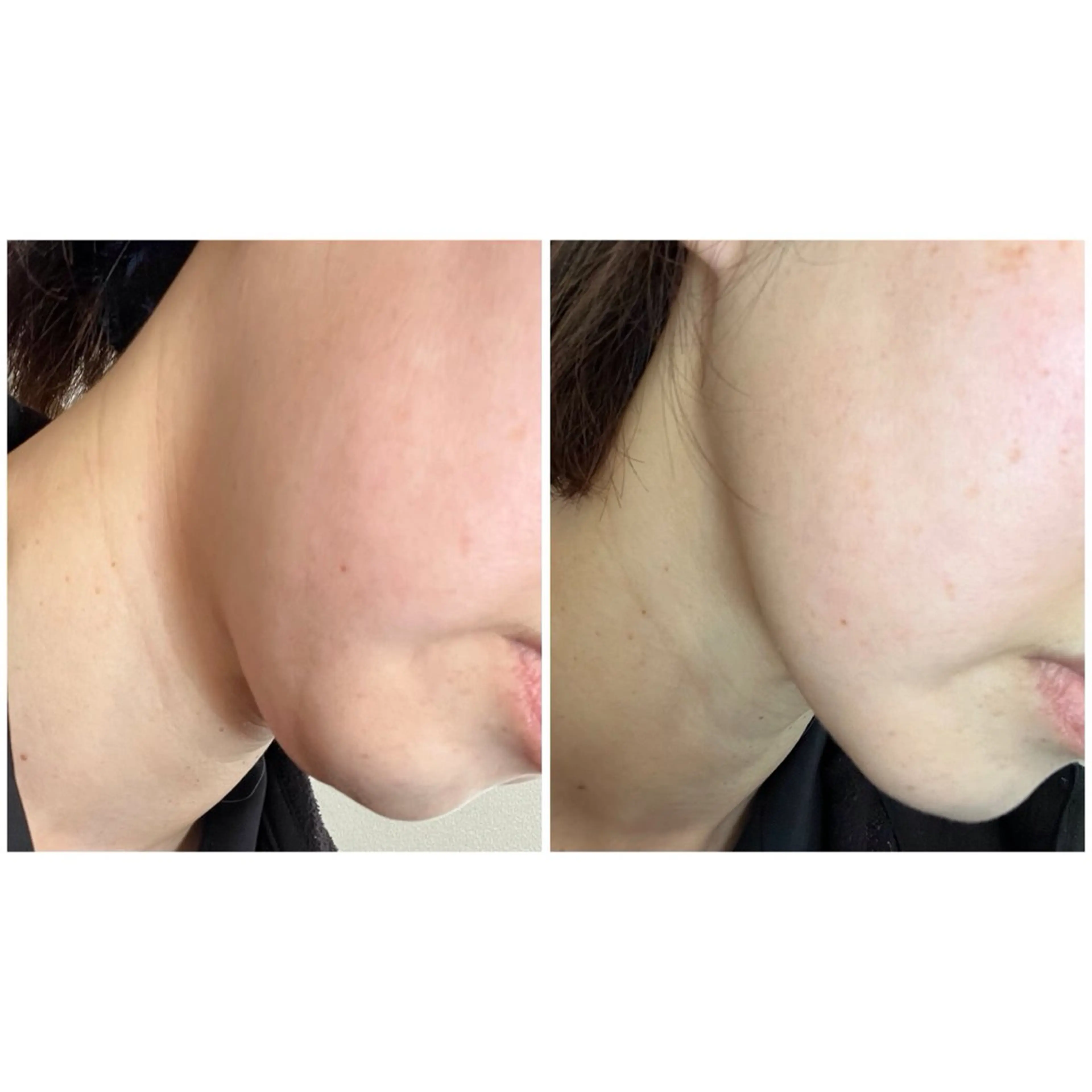 エステ バスト美肌小顔専門 Mimpi【ミンピ】のエステ・リラクイメージ