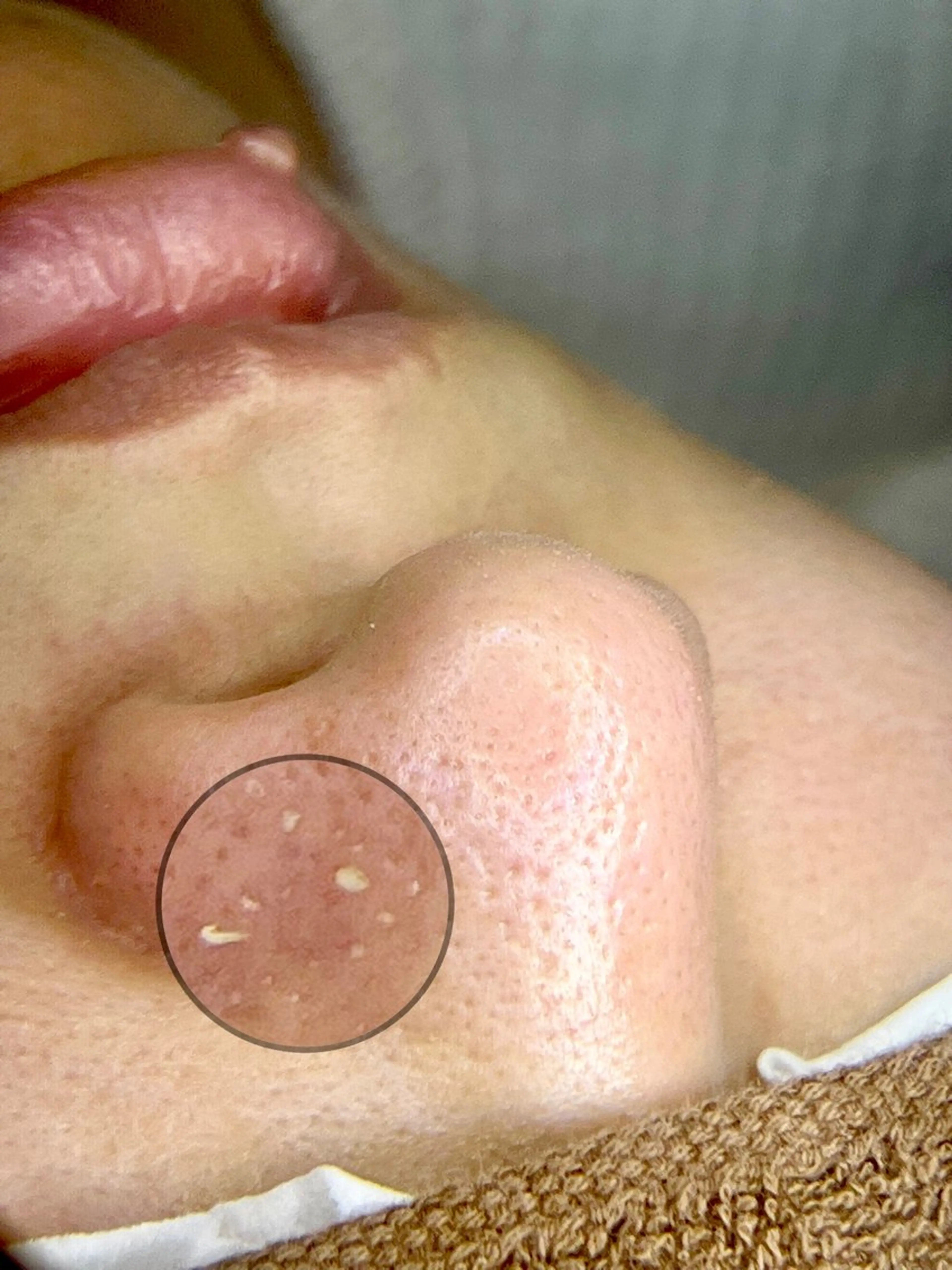 ulu 眉毛ハーブ毛穴肌改善の眉毛・アイブロウイメージ