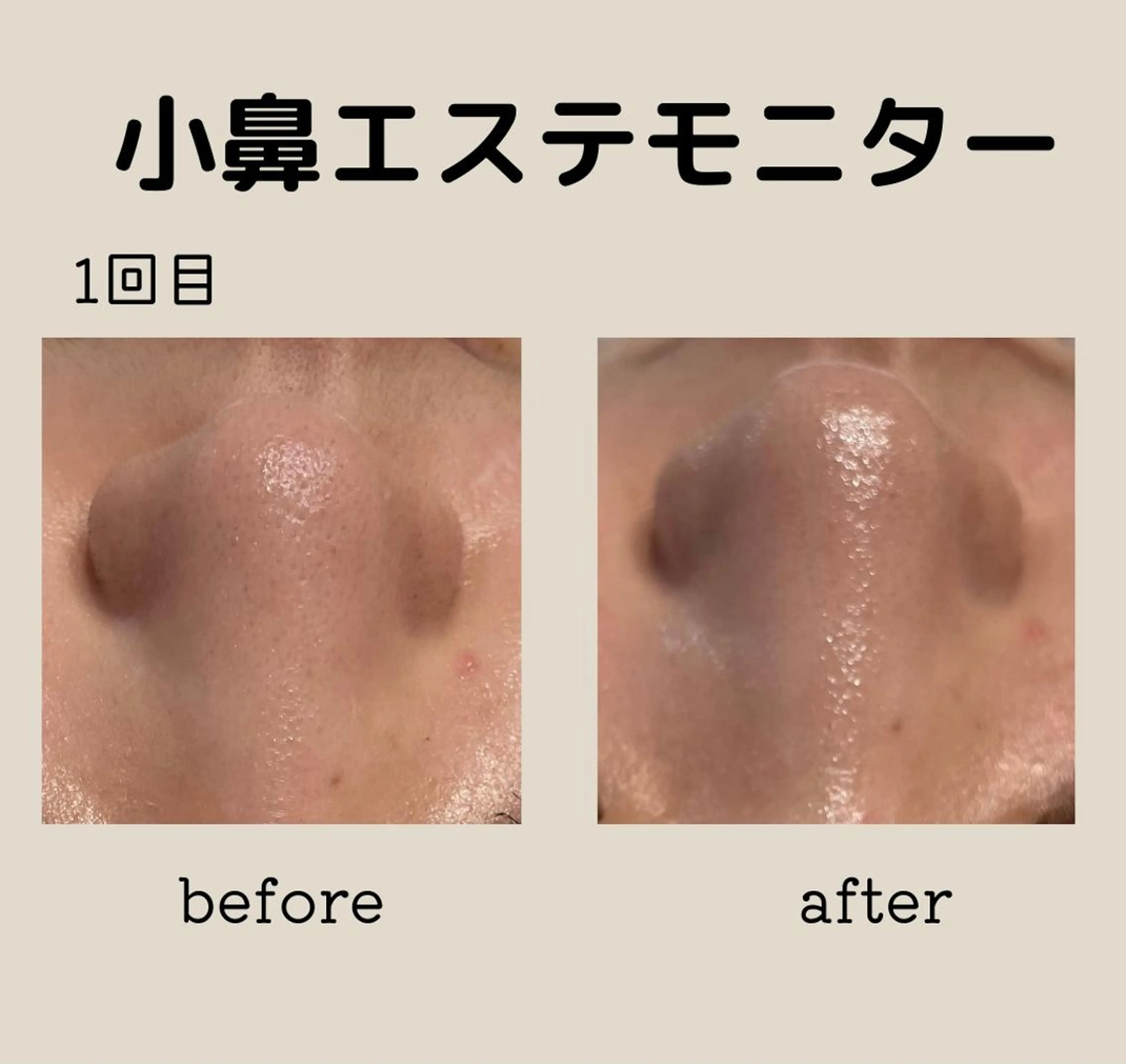 エステ DeI'm   名古屋栄所属・小林 玲菜のエステ・リラクイメージ