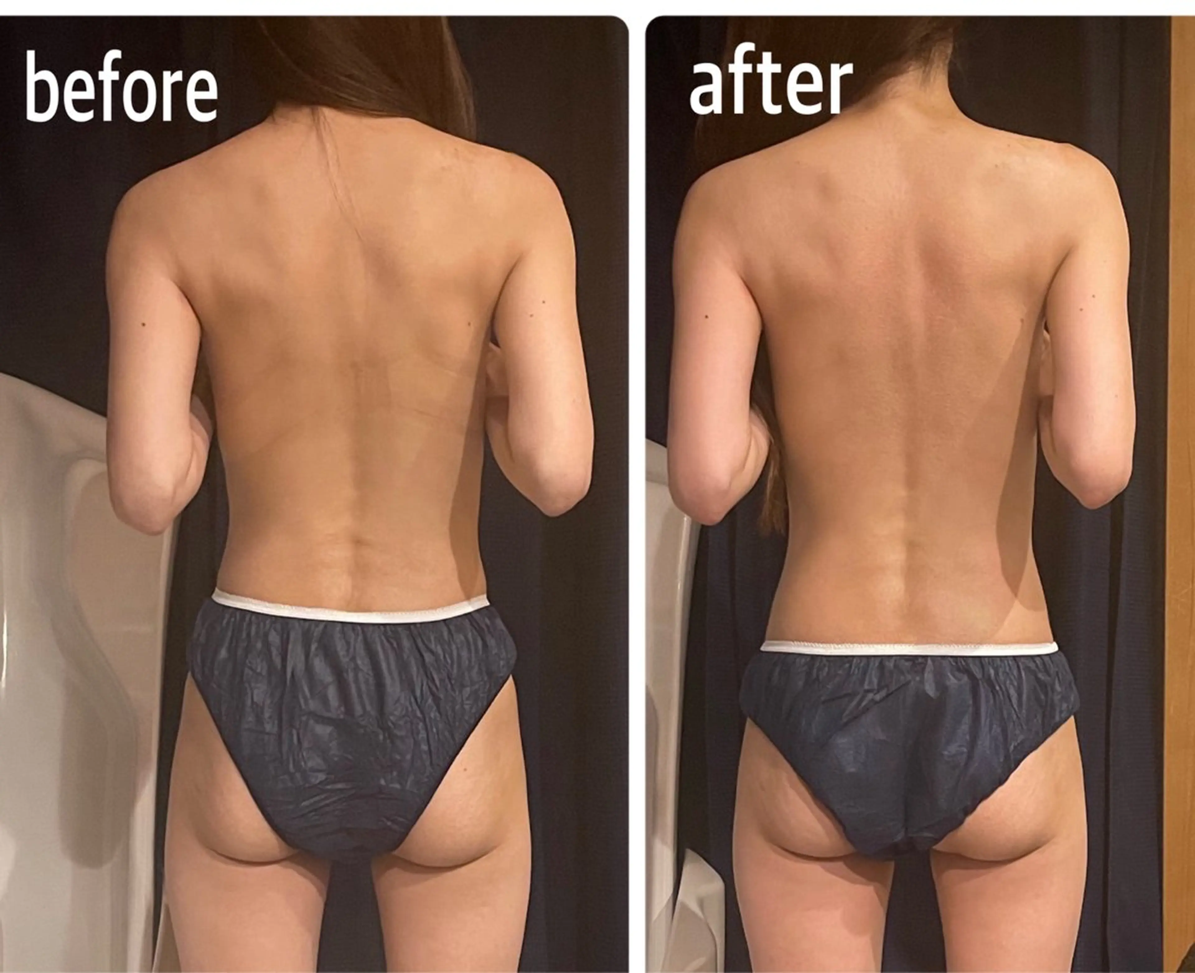 人気のKONOMI式全身リンパケア120分で肩凝りを改善し、背中の厚みをなくす神業リンパケア‼︎の写真