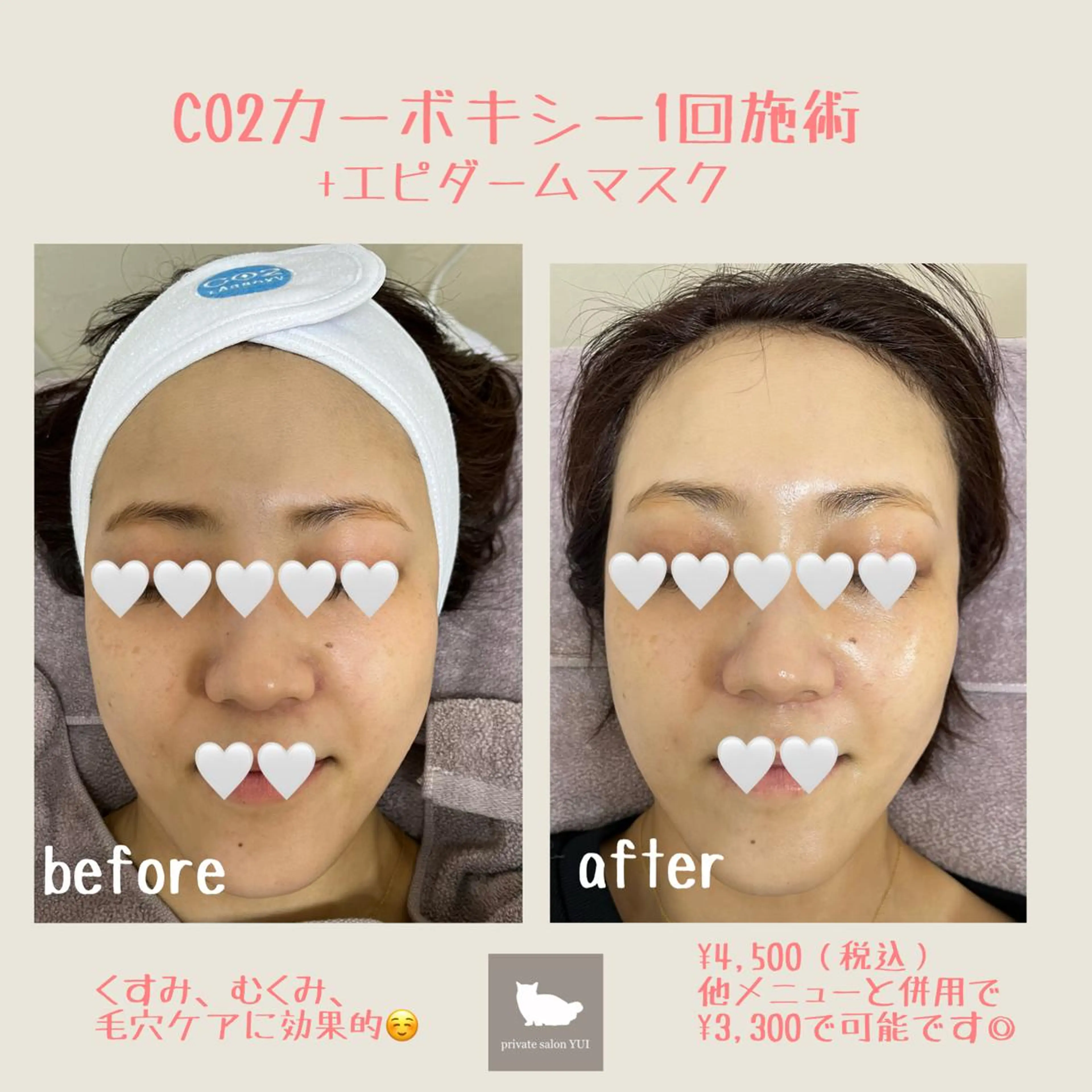 1ヶ月後も半分残る 高持続LEDエクステのマツエク・マツパデザイン