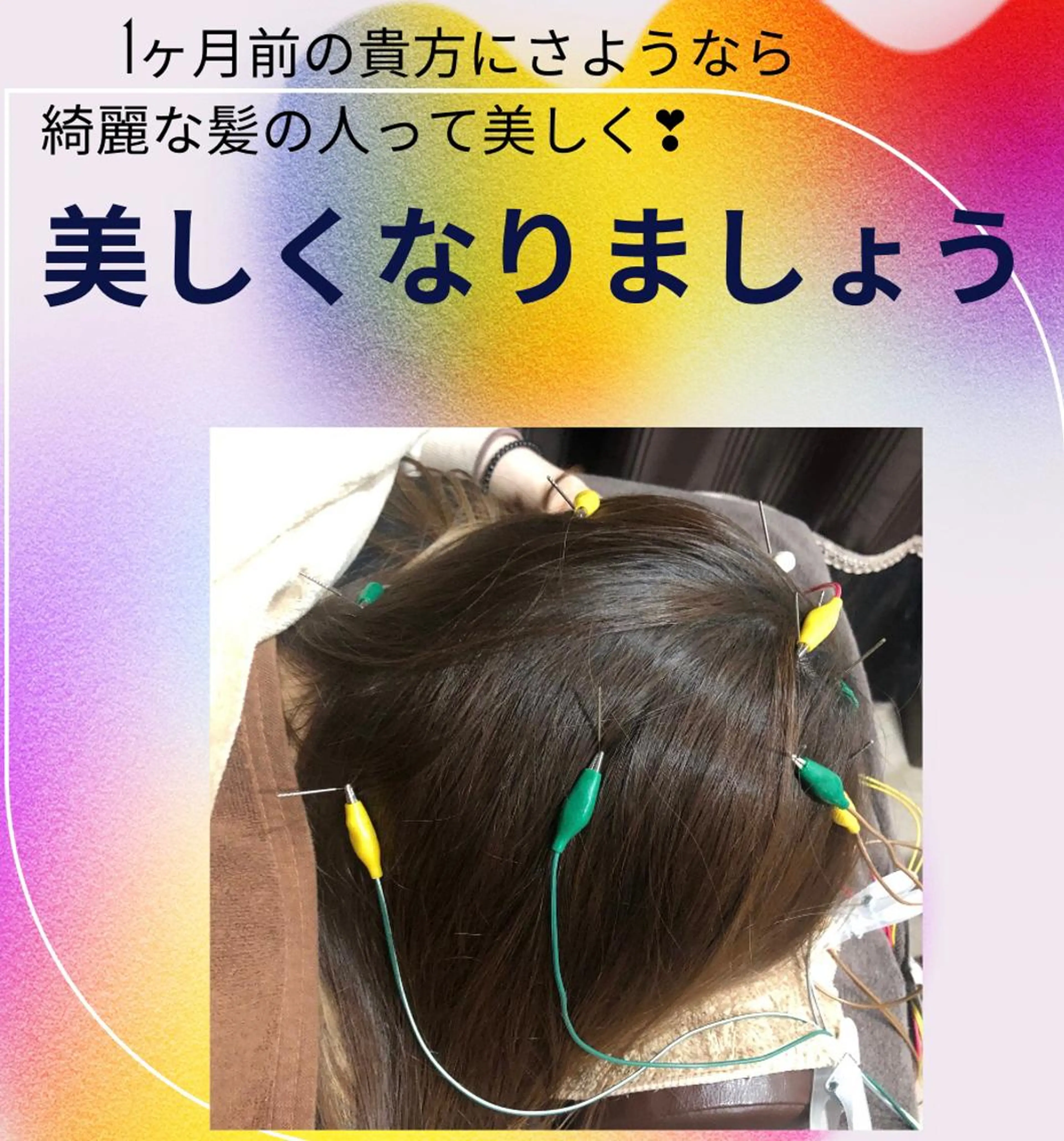 ヘアエステ鍼/髪の毛にハリツヤ✨元気になり昔の立ち上がりを回復させましょう。の写真