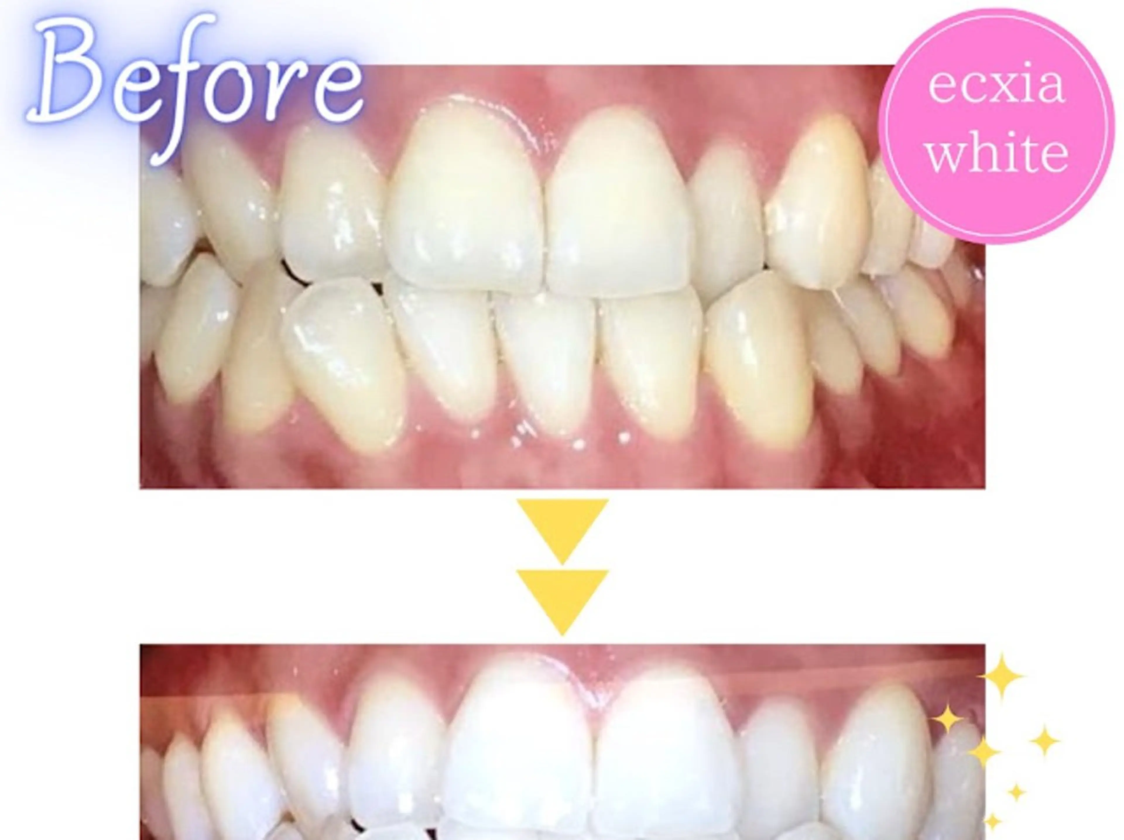 エステ セルフホワイトニング エクシア浜松店のエステ・リラクイメージ