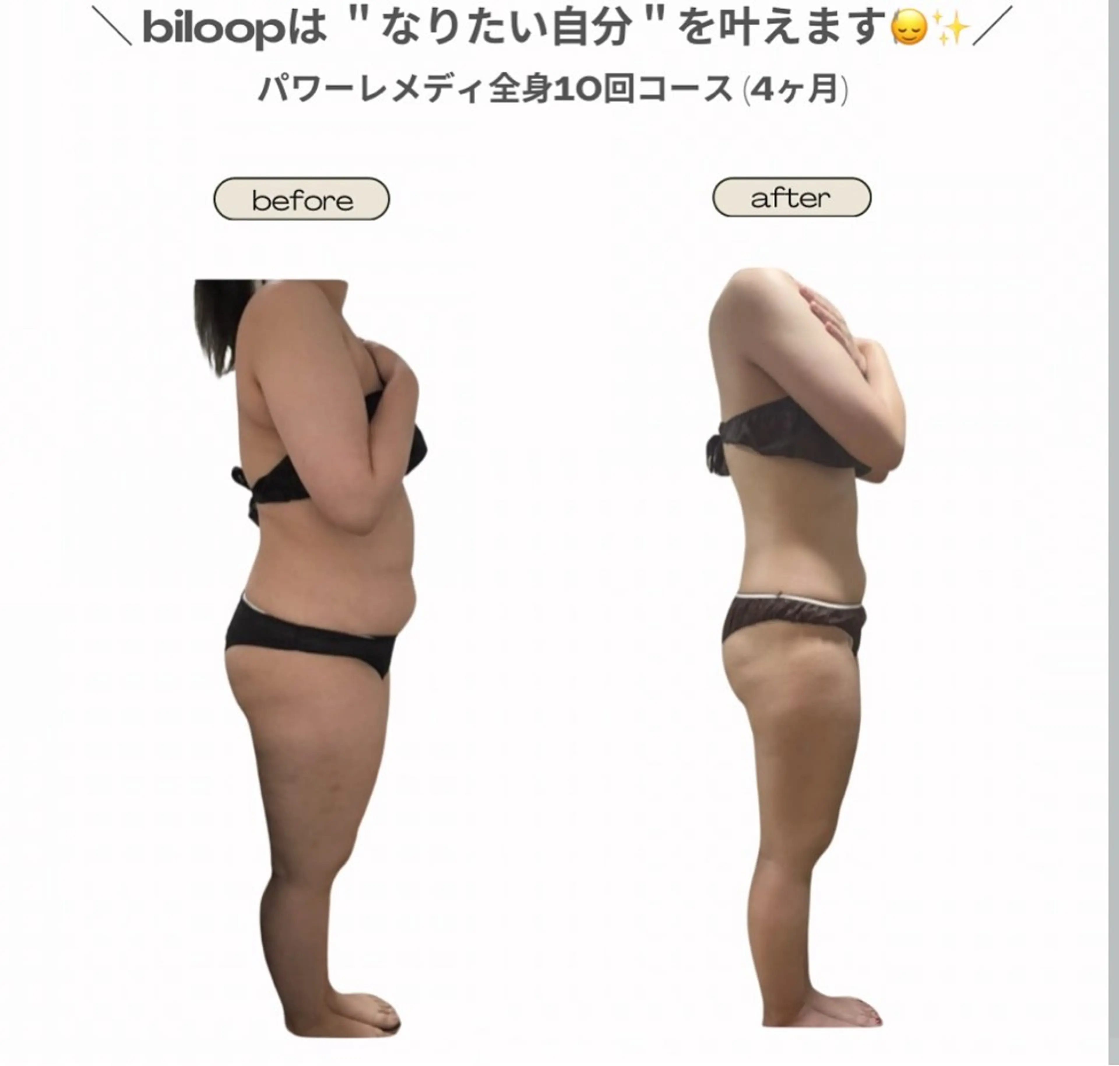エステ リラク biloop所属・《本気痩せ×疲労改善 》  BILOOPのエステ・リラクイメージ