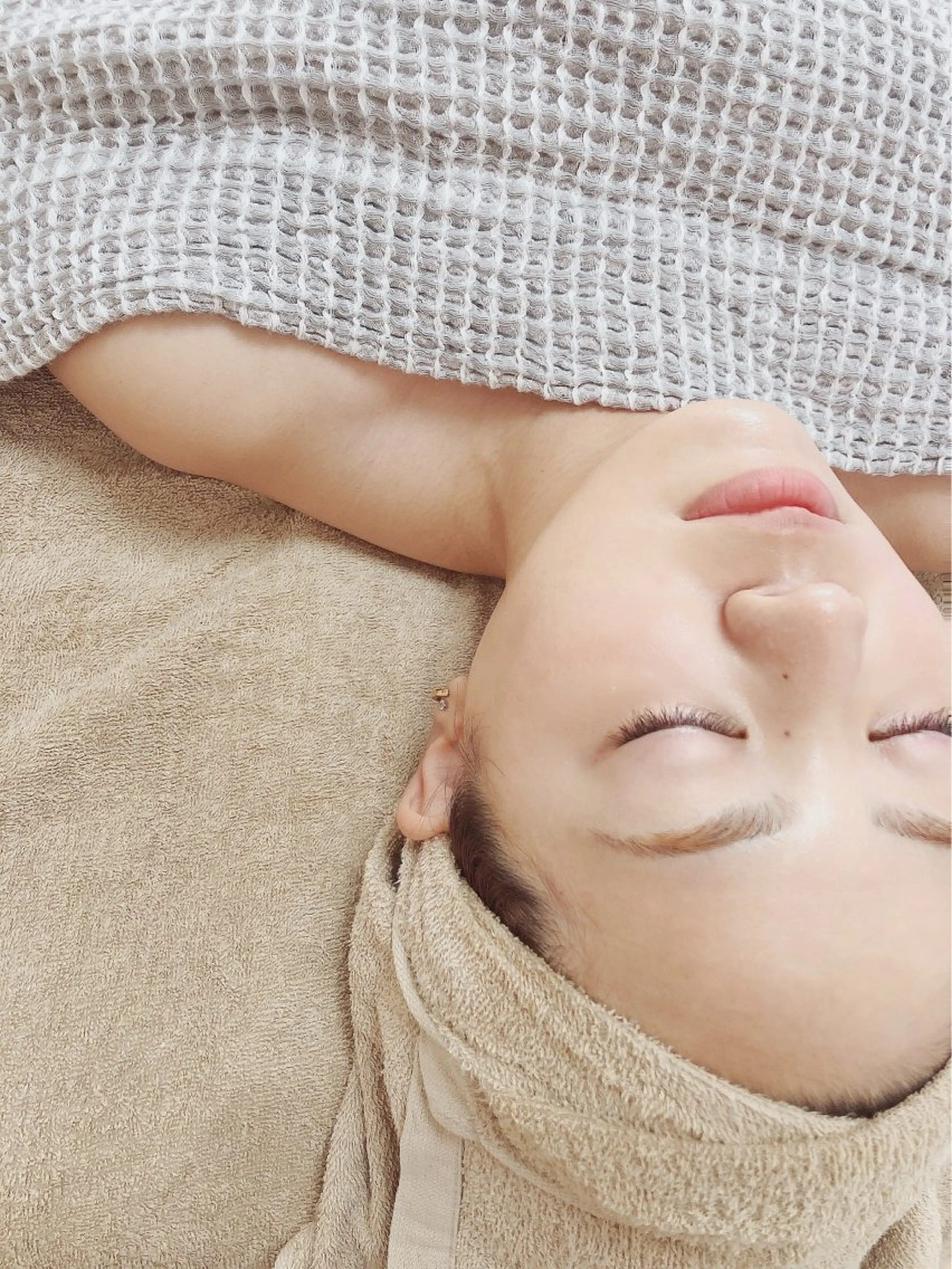 お顔脱毛の写真