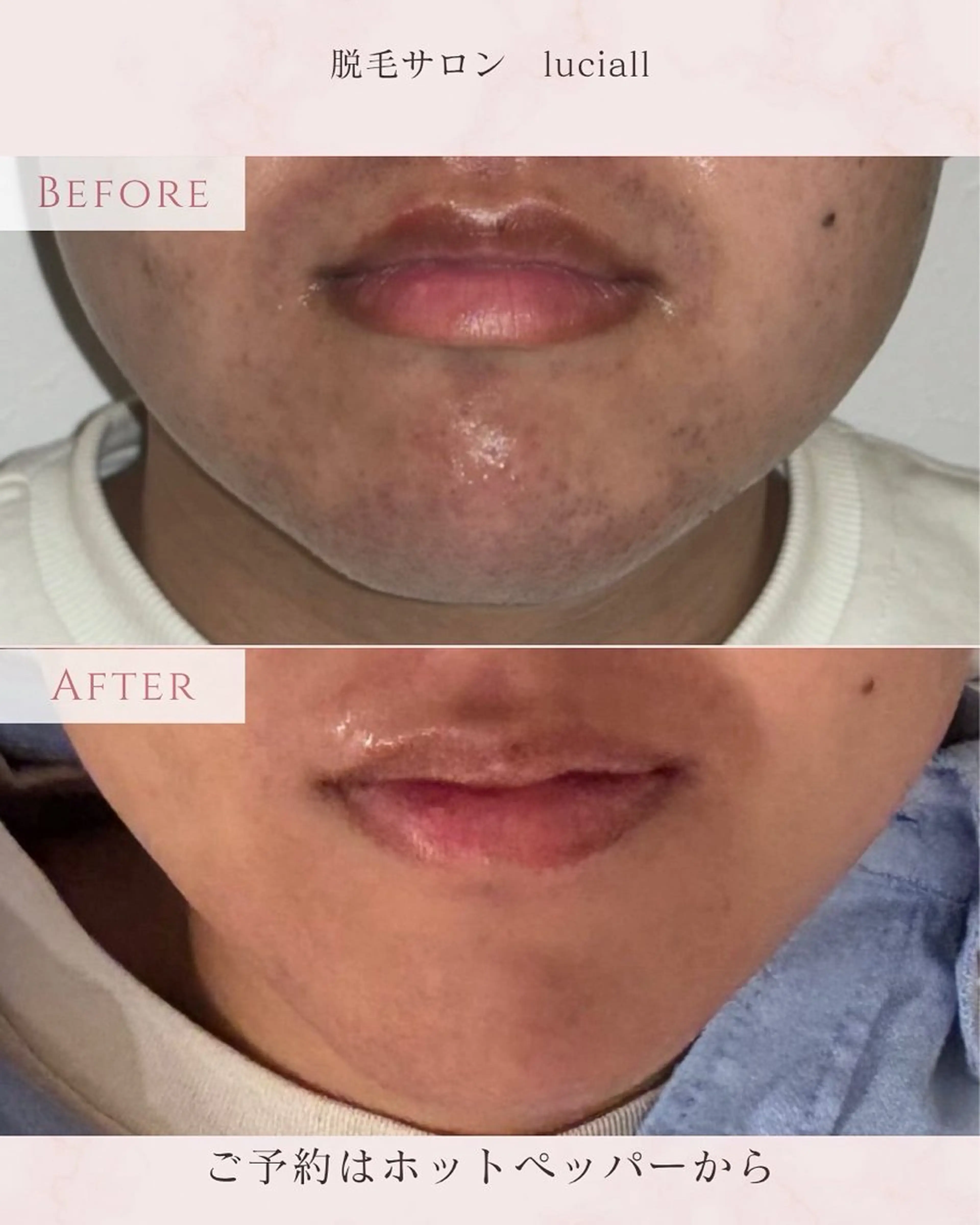 LUCIALL 【ルシアル】所属・【LUCIALL】 眉ワックス、脱毛のエステ・リラクイメージ