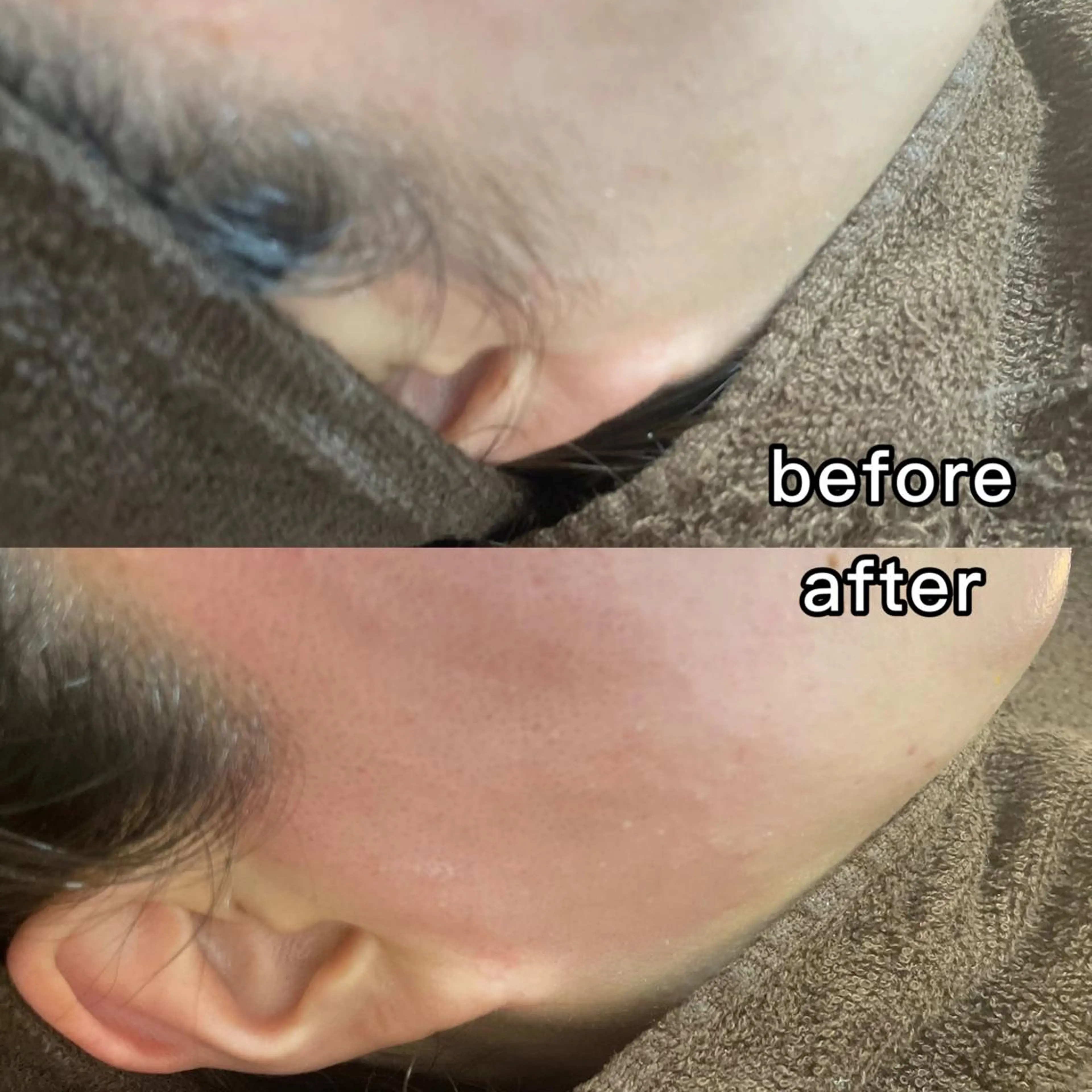 脱毛 salon improve所属・Salon Improveのネイルデザイン