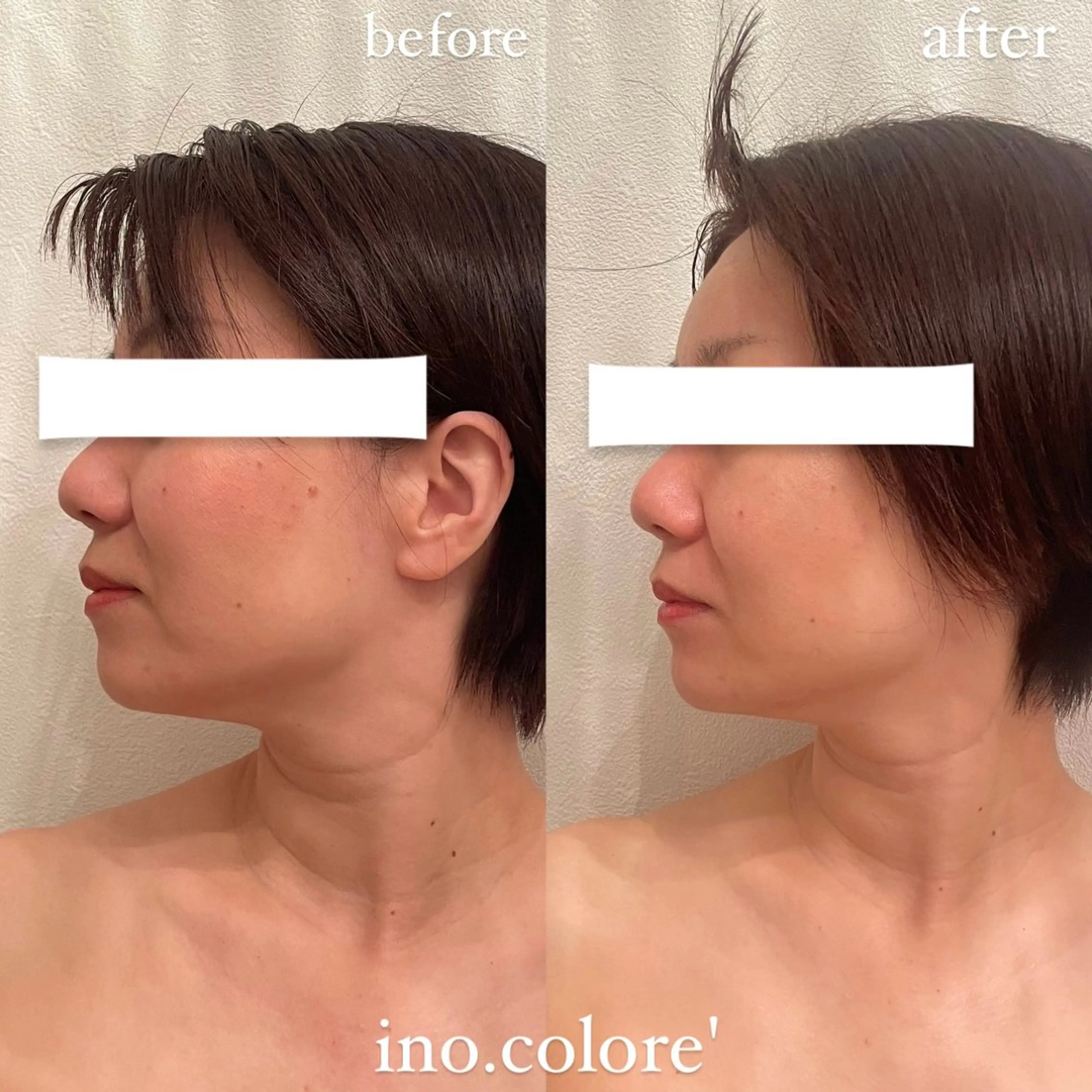 エステ リラク エステサロンino.colore'所属・小顔サロン ino.coloreのエステ・リラクイメージ