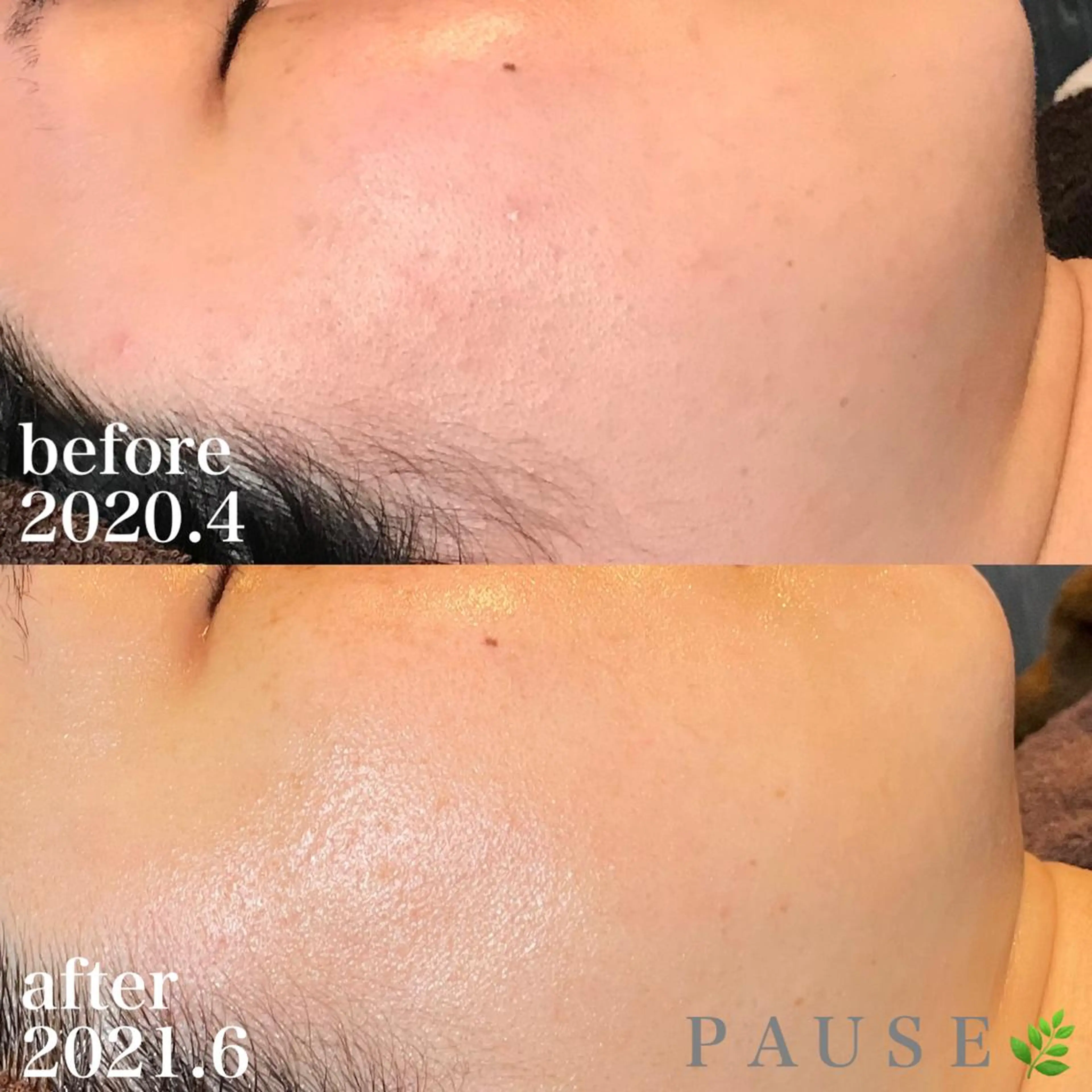 エステ 浜野 恵美のエステ・リラクイメージ