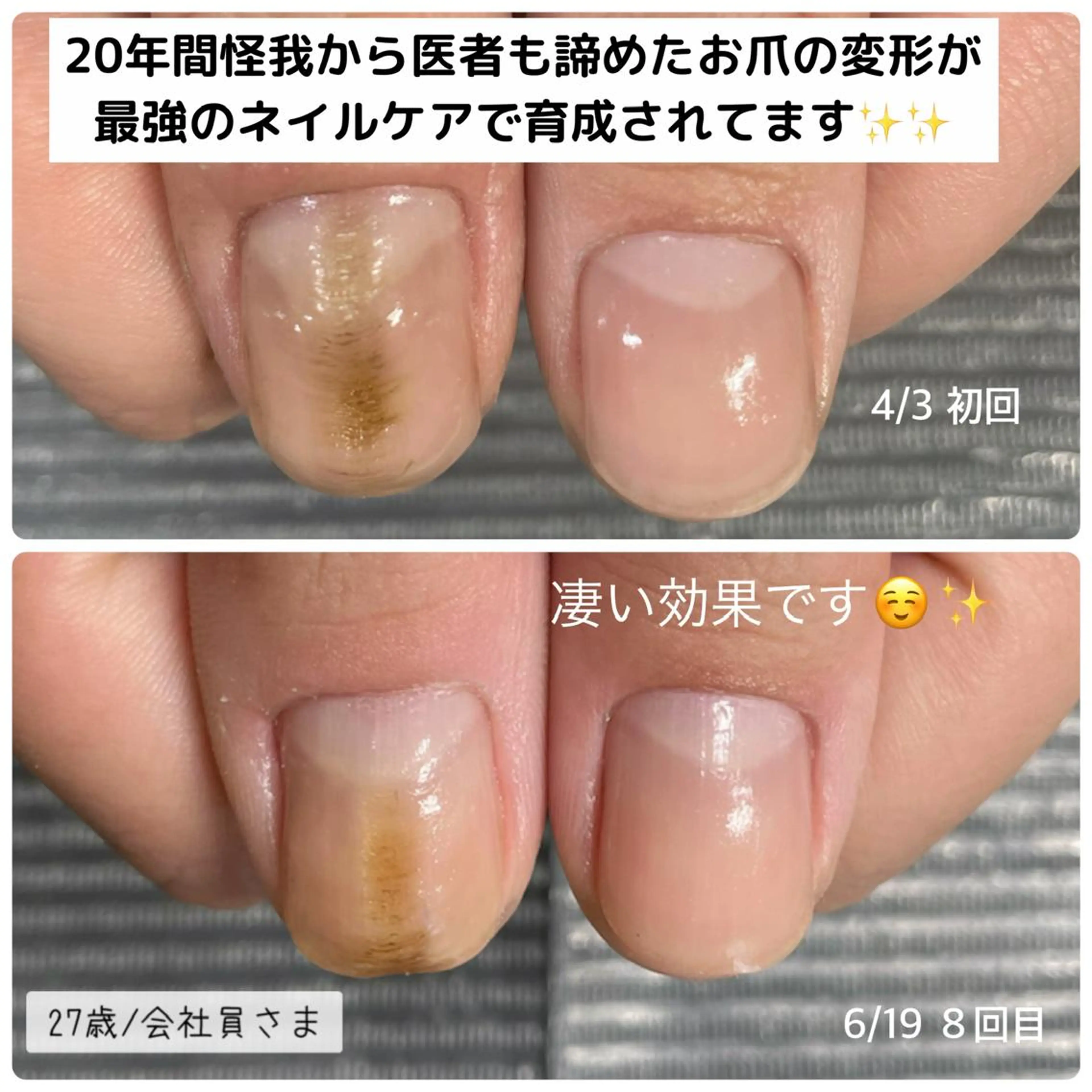 ネイル 奥園 良恵のネイルデザイン