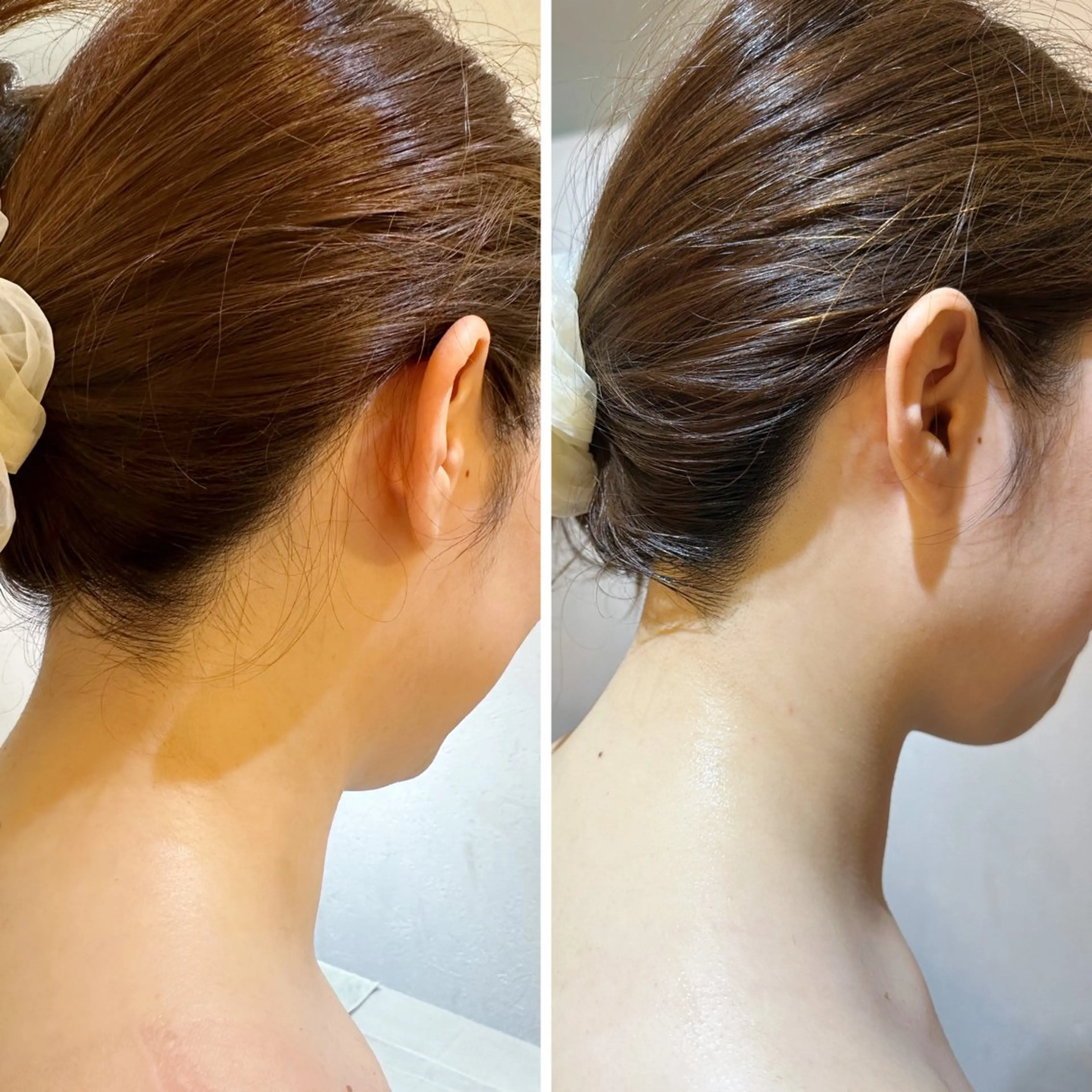 脱毛 うなじ脱毛/美肌脱毛 LABELのエステ・リラクイメージ