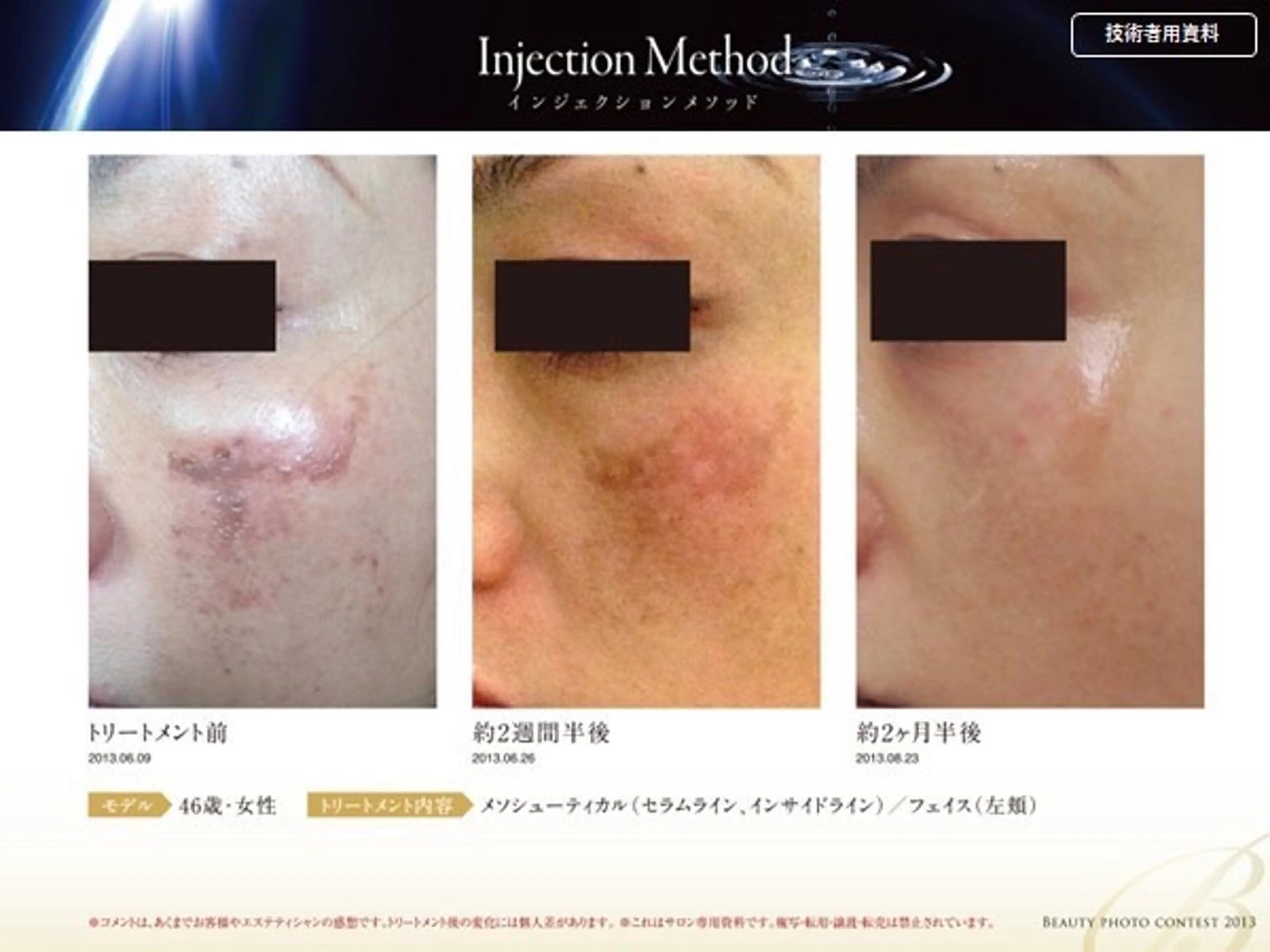 リュー・.ド・ボウテ所属・肌質改善サロン★ リュー・ド・ボウテのエステ・リラクイメージ