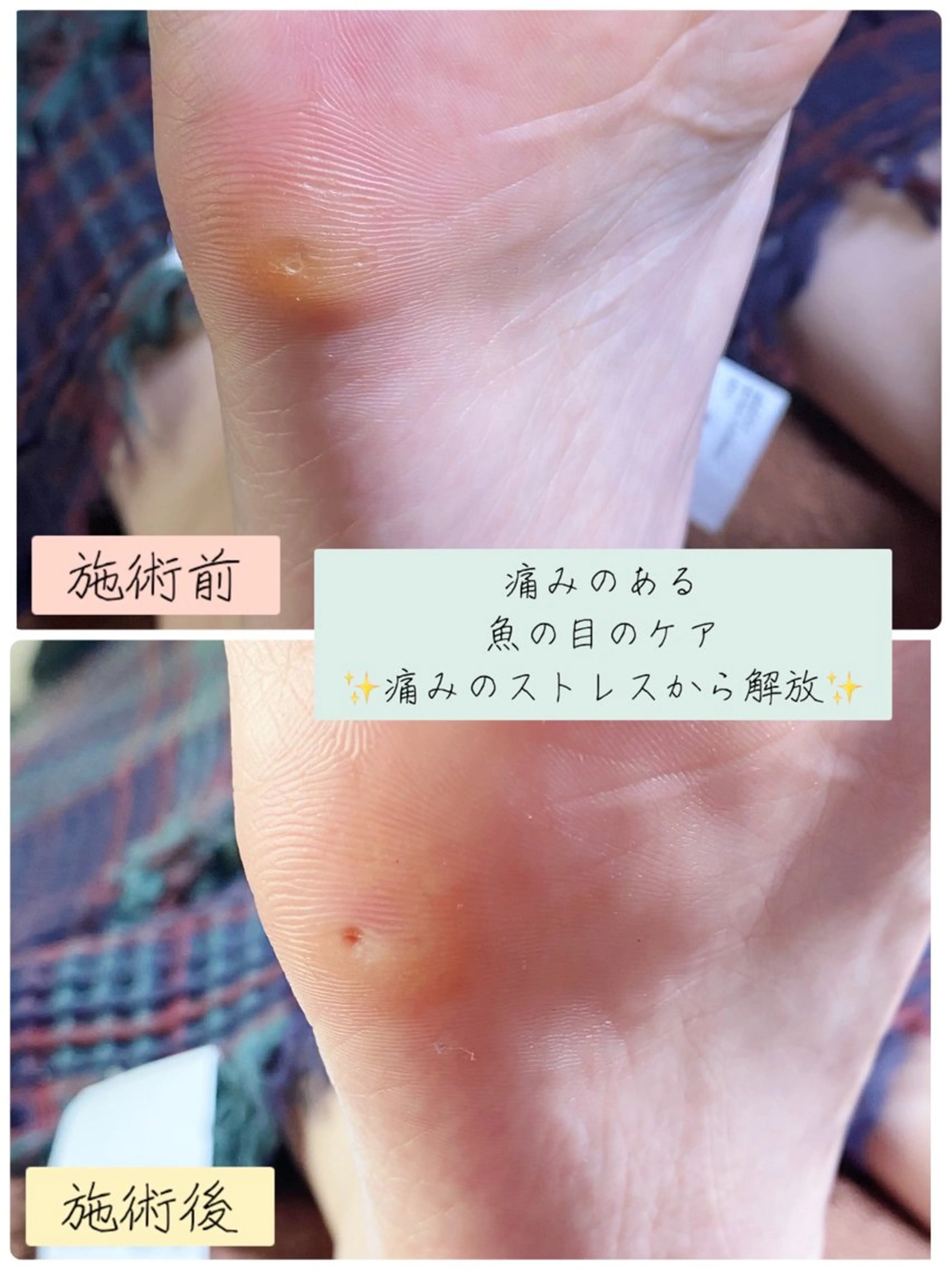 ネイル フットネイル フットネイル Studio Jivanのネイルデザイン