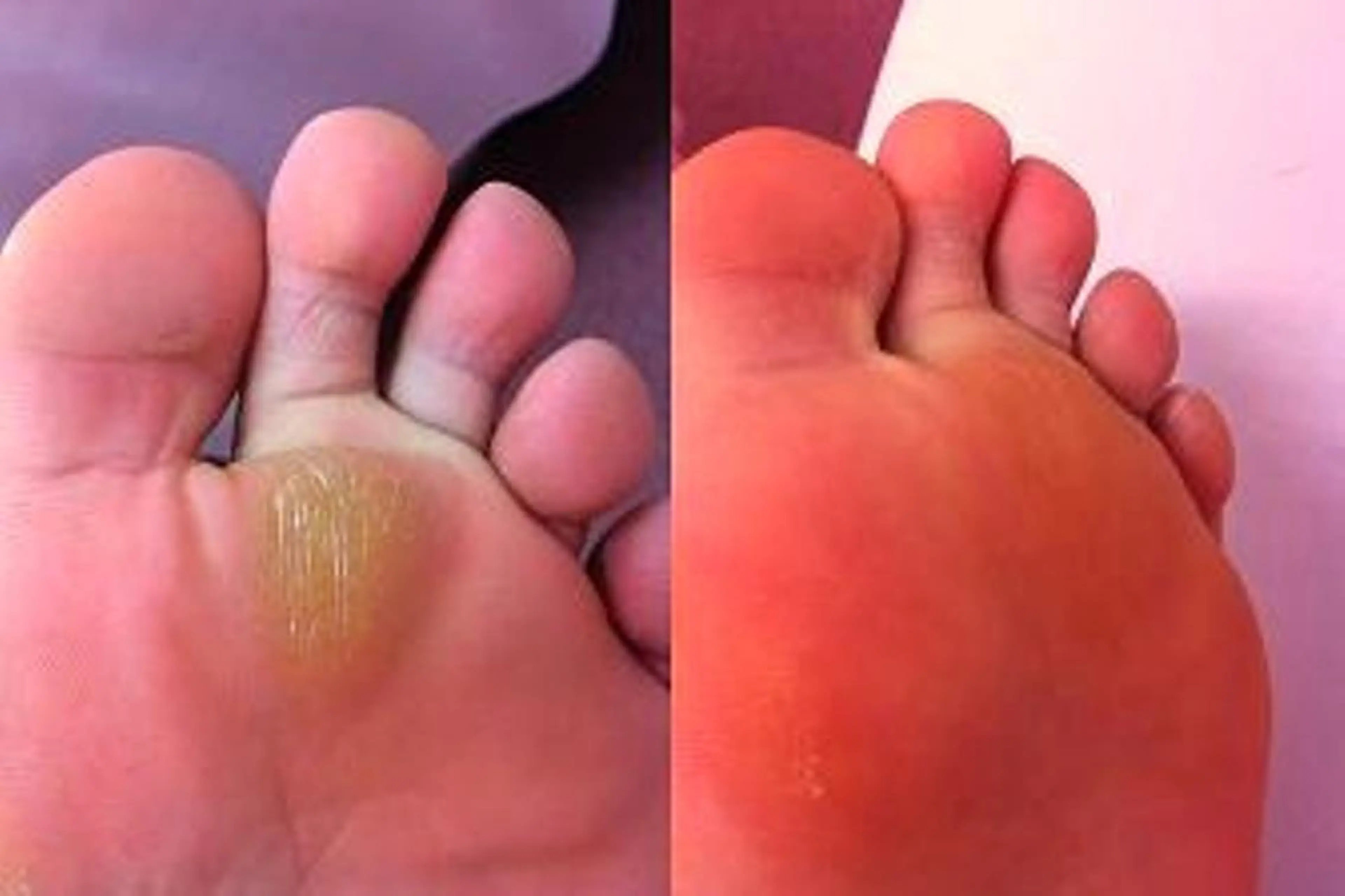 ネイル フットネイル その他(ネイル) 同心整骨院 美容鍼・整体・小顔のエステ・リラクイメージ