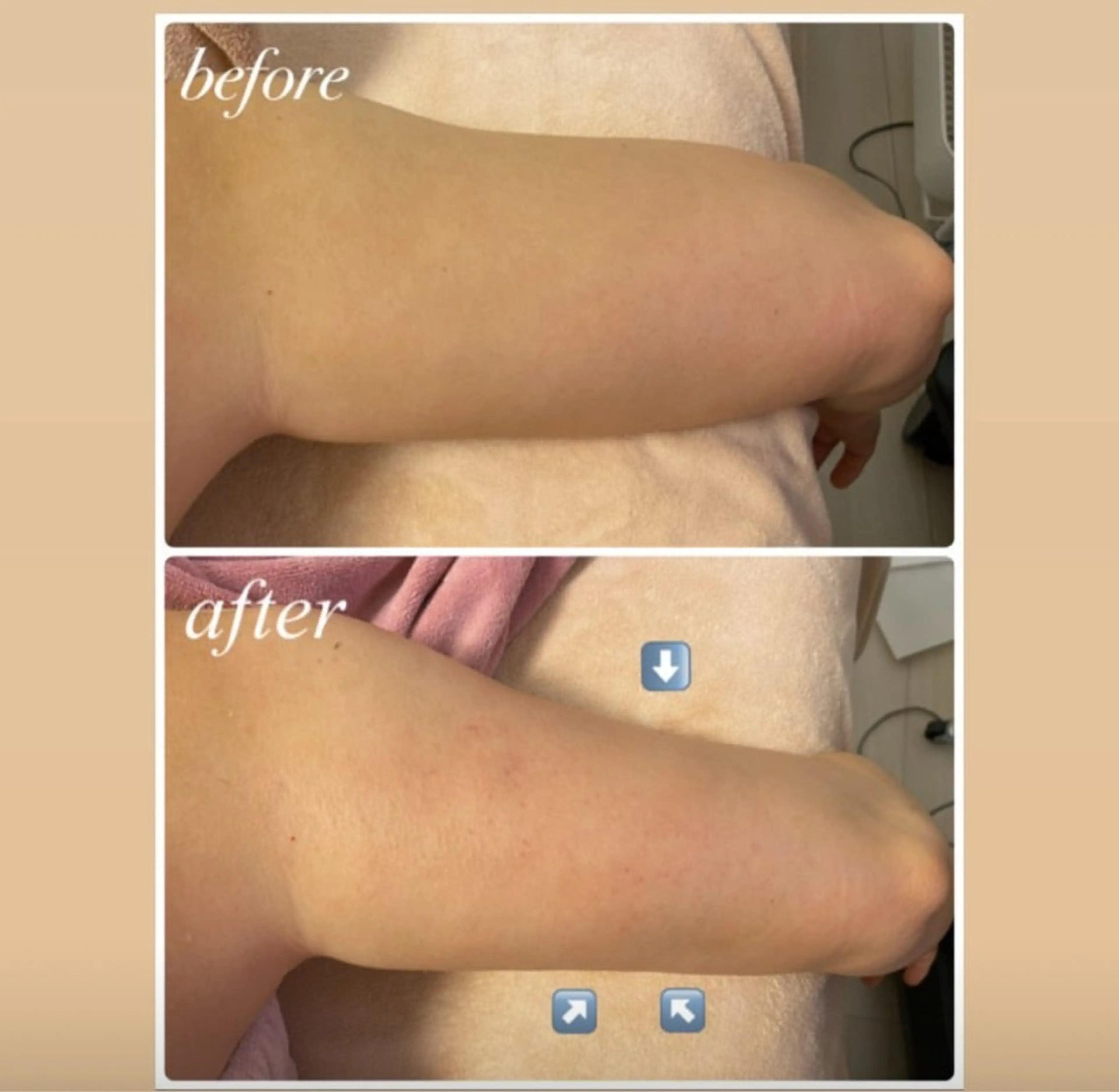 La Colzaのネイルデザイン