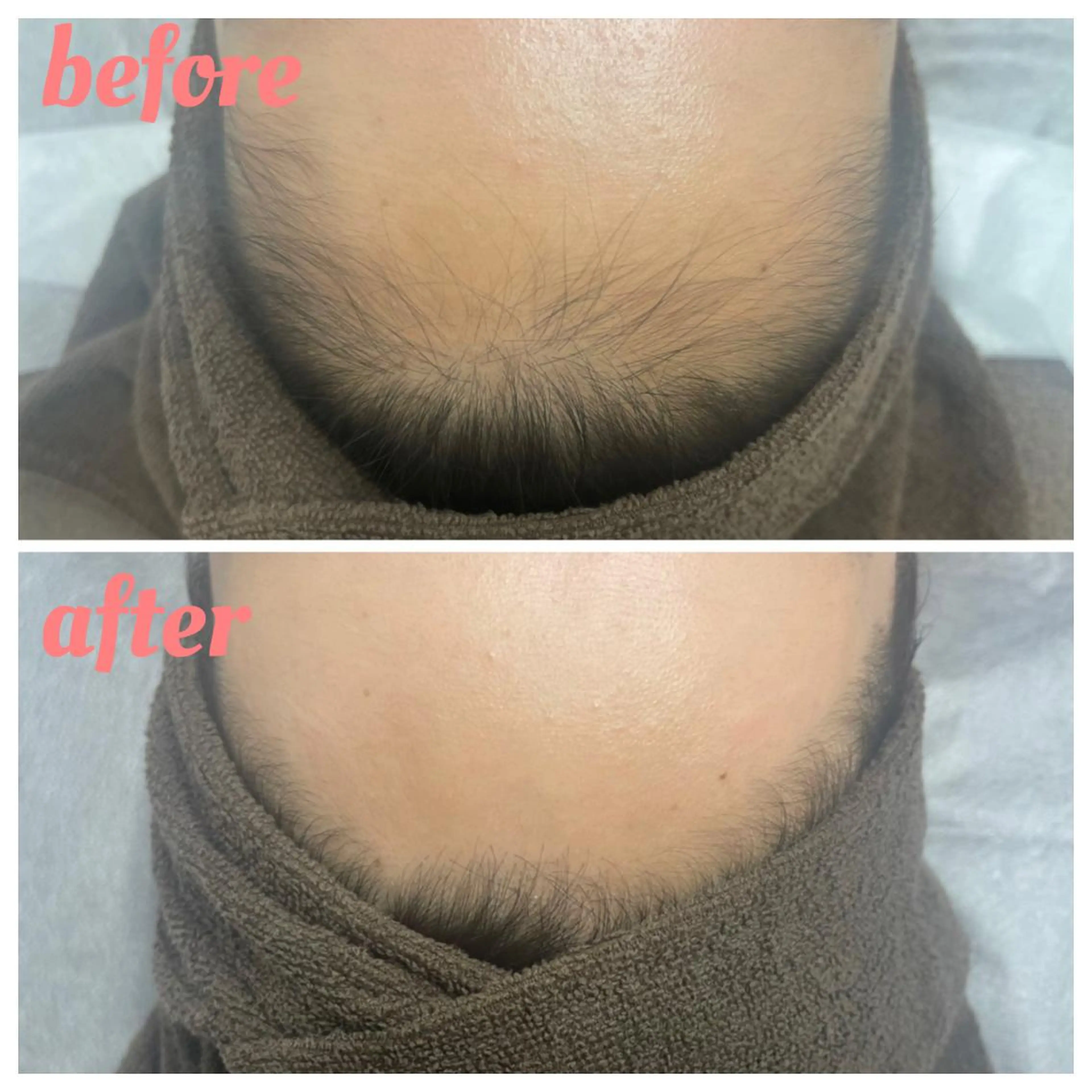 脱毛 脱毛サロンLULA 恵比寿店　笠松のエステ・リラクイメージ