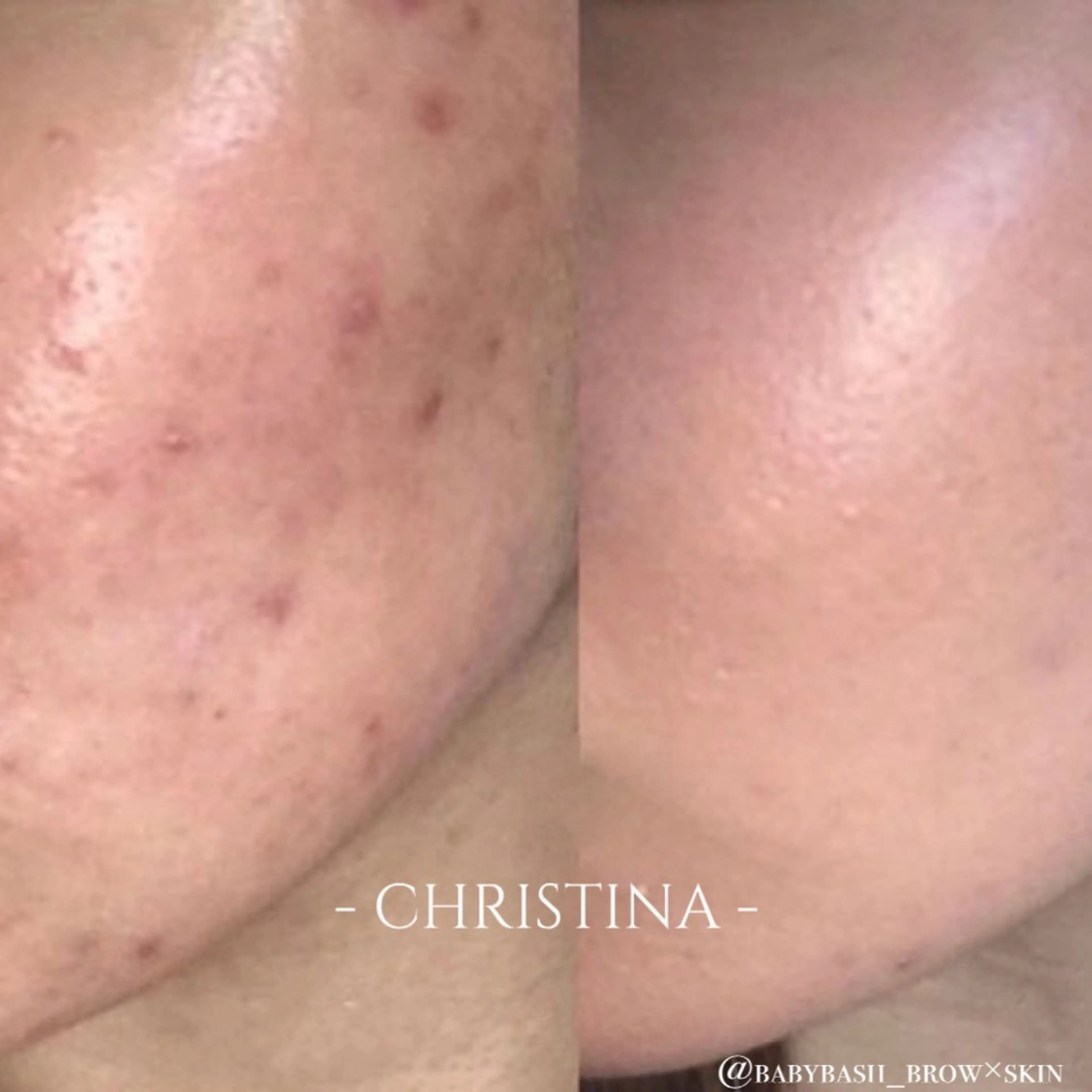 エステ BABY BASH BROW×SKIN所属・FUJIMOTO AOIのエステ・リラクイメージ