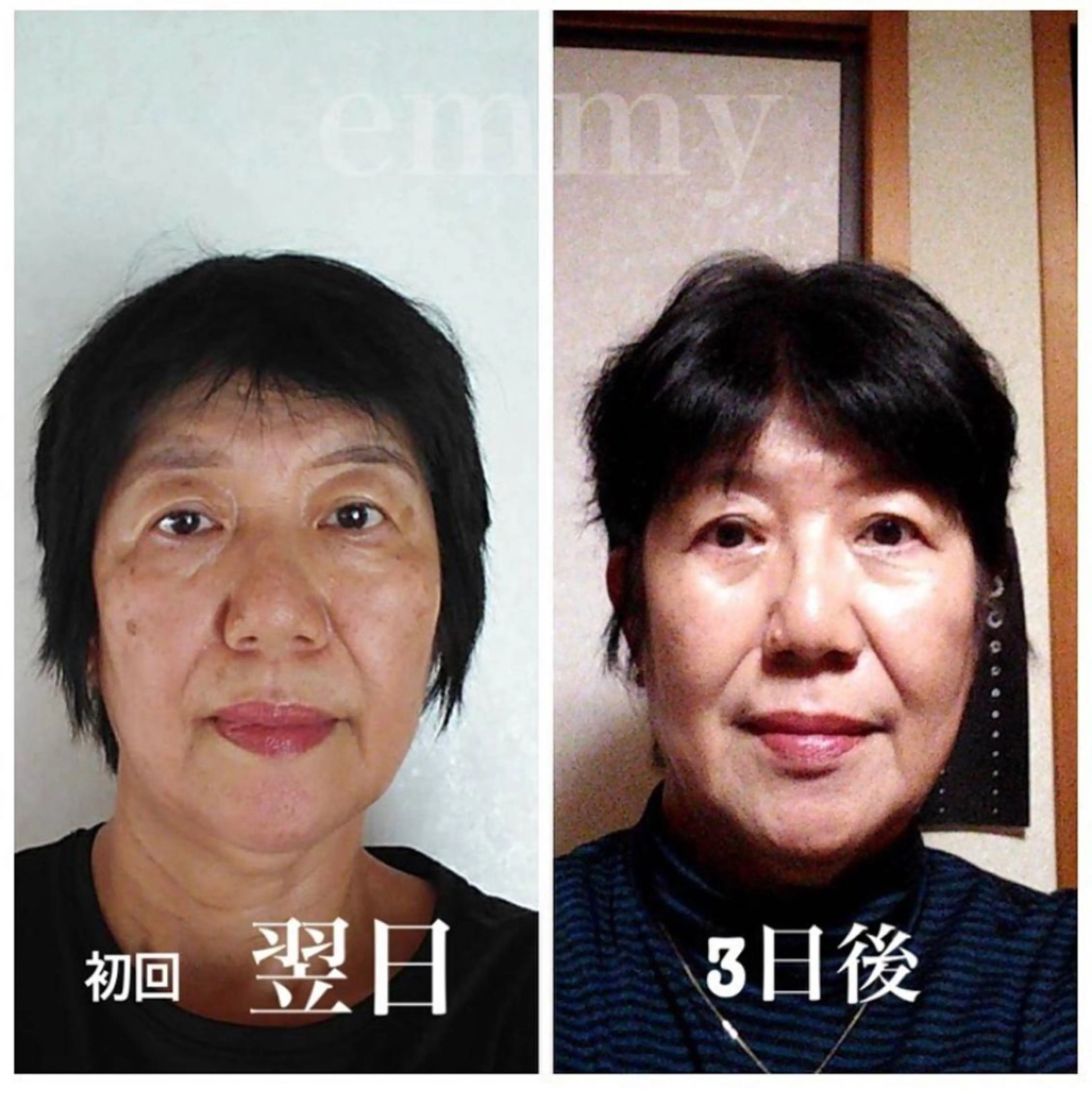 エステ リラク 小顔と ヘッドスパのお店のエステ・リラクイメージ