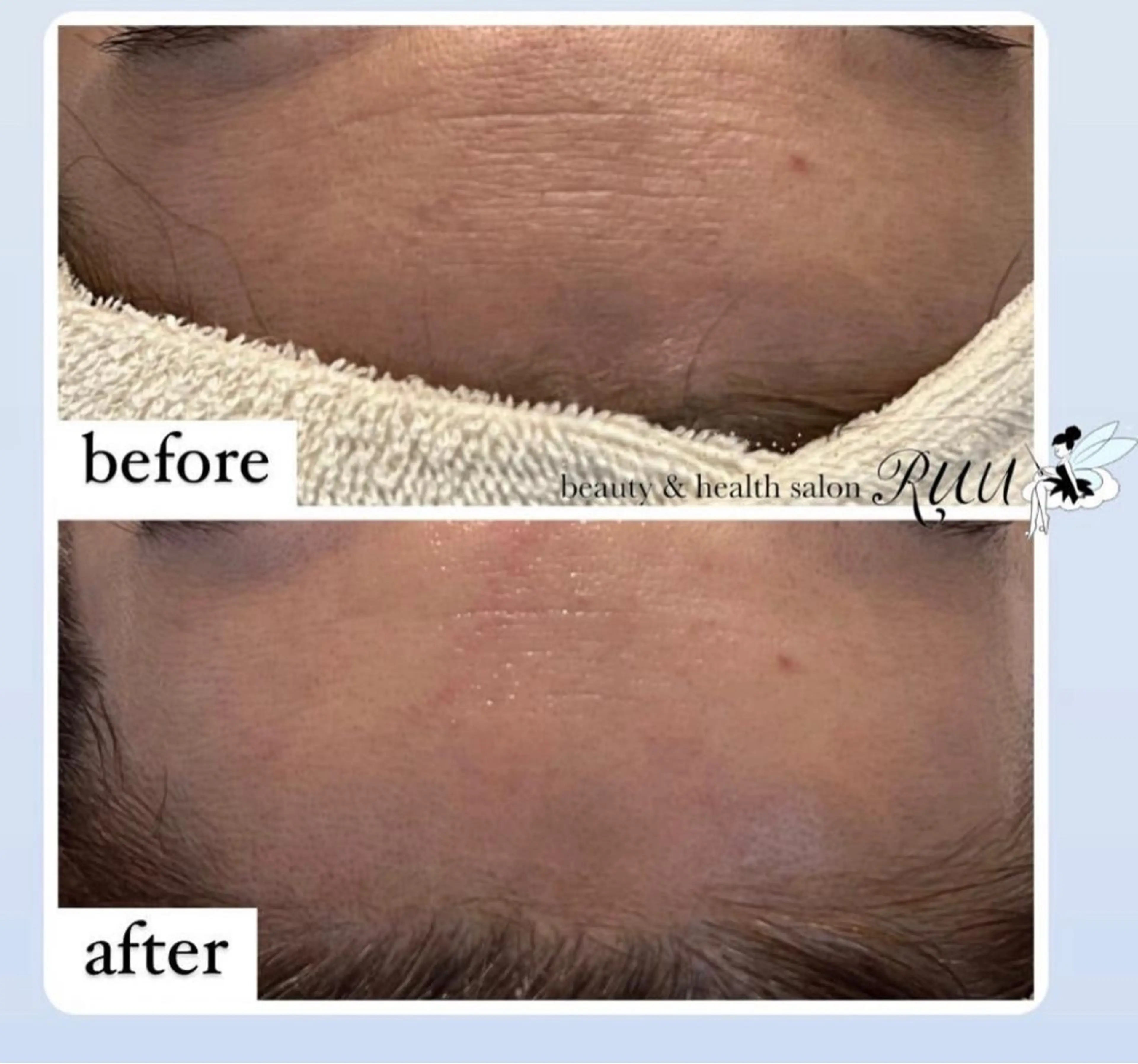 エステ 【頭痛、睡眠改善】 salon RUUのエステ・リラクイメージ