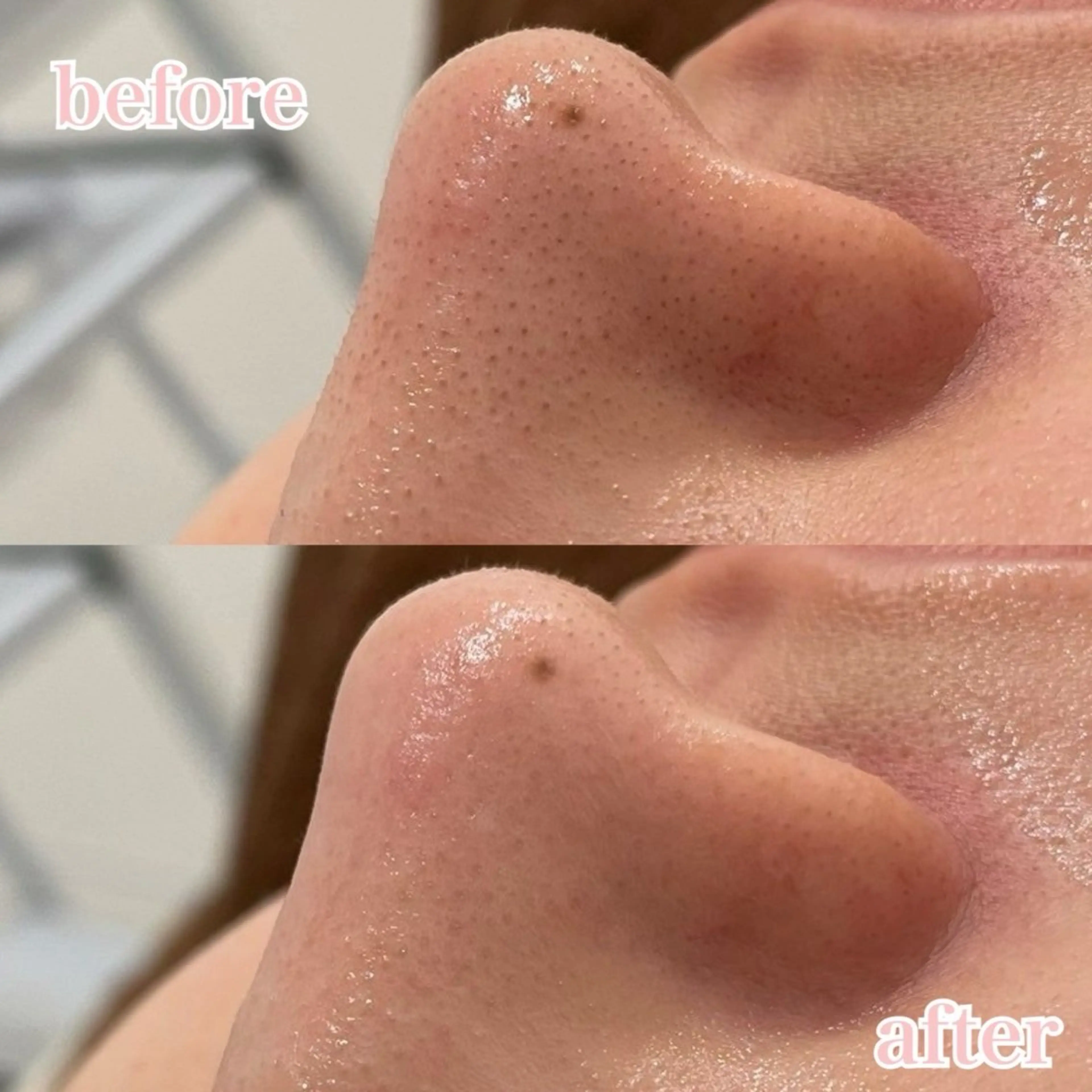 肌管理専門店Whitelabo堺東店所属・おだ あみのエステ・リラクイメージ