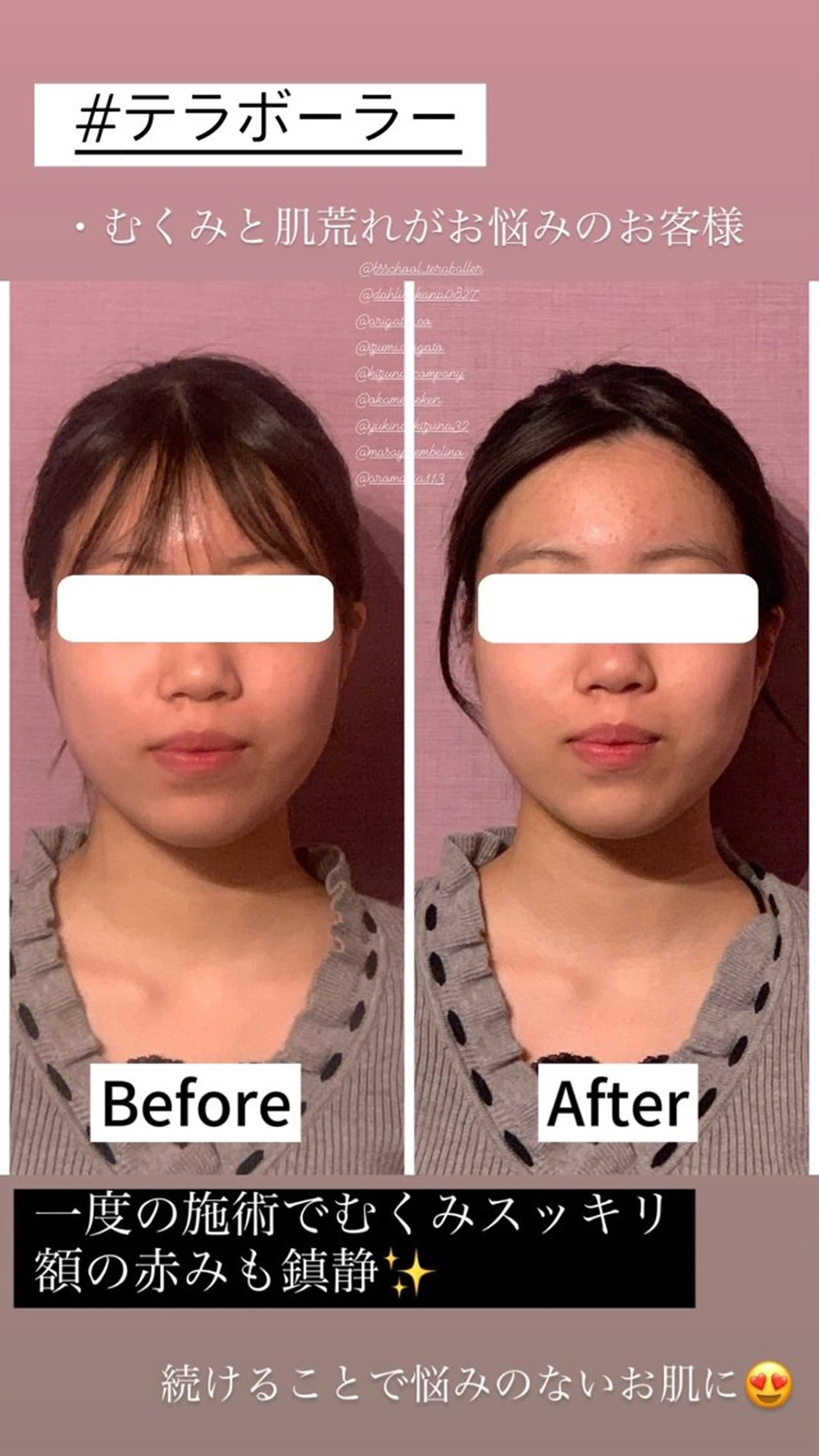 エステ アンベリーノ Yuuriのエステ・リラクイメージ