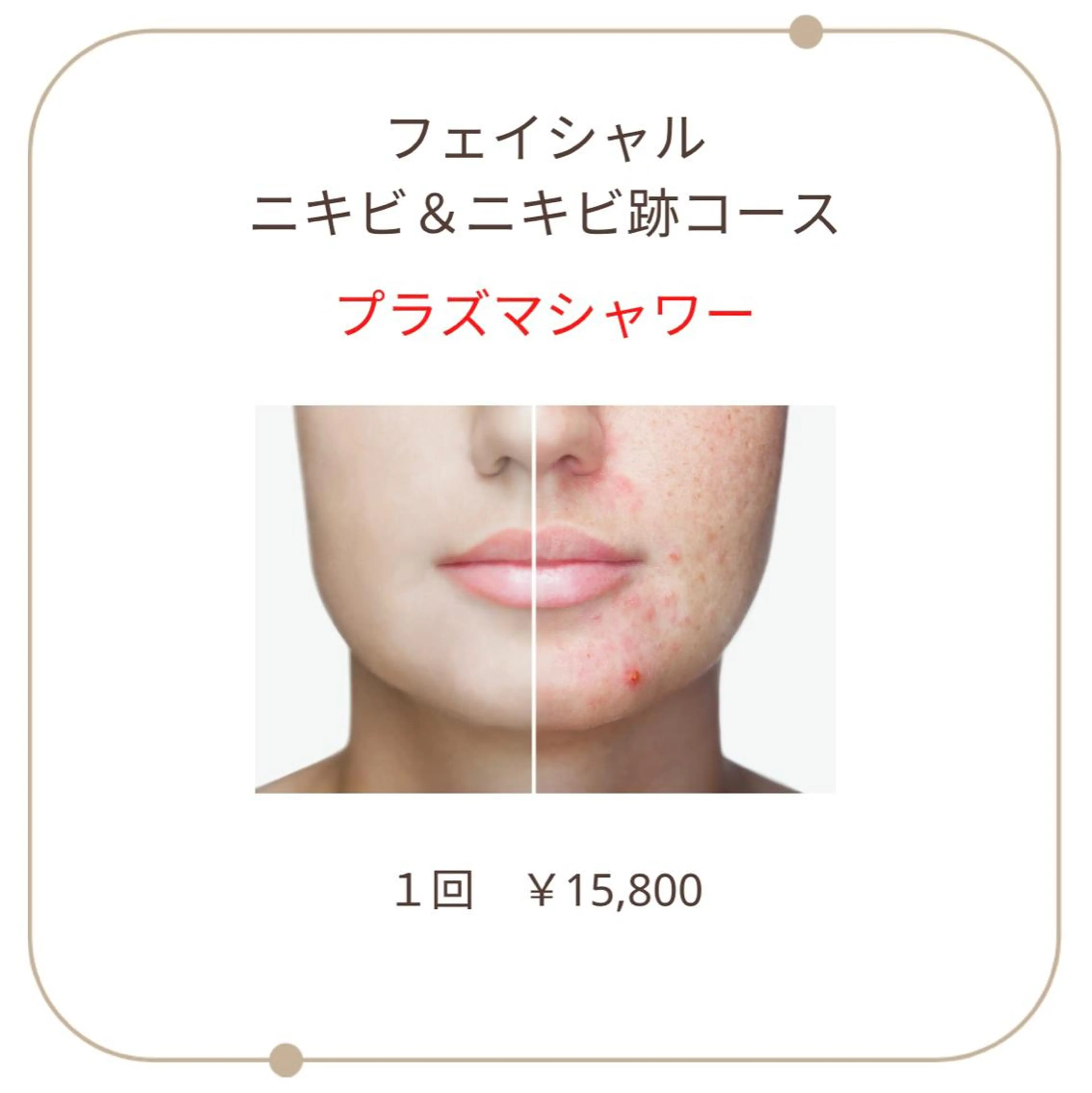 ベラージュ【美背中・ 美尻・フェイシャル】のエステ・リラクイメージ