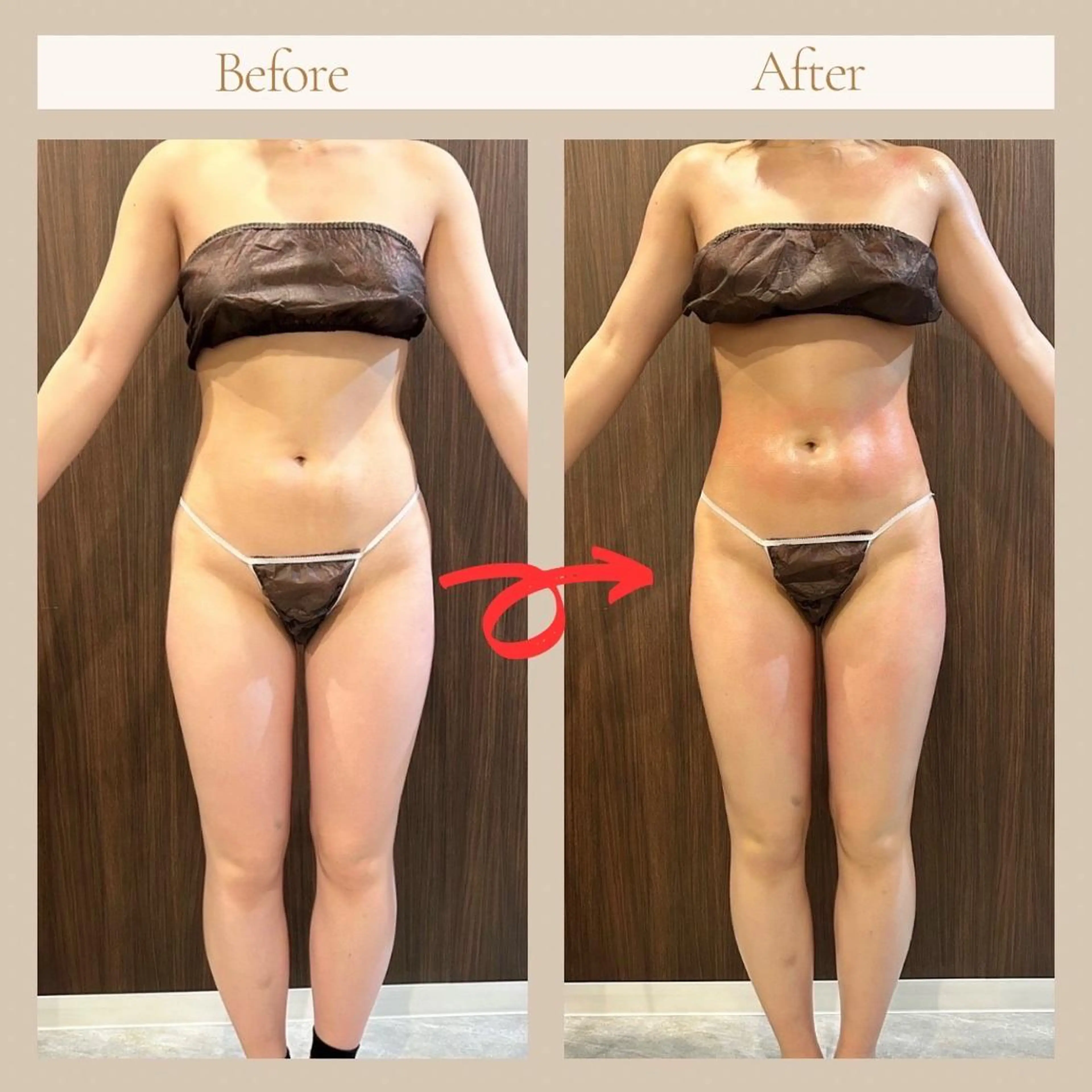 BLANCHE所属・Blanche 心斎橋のその他イメージ