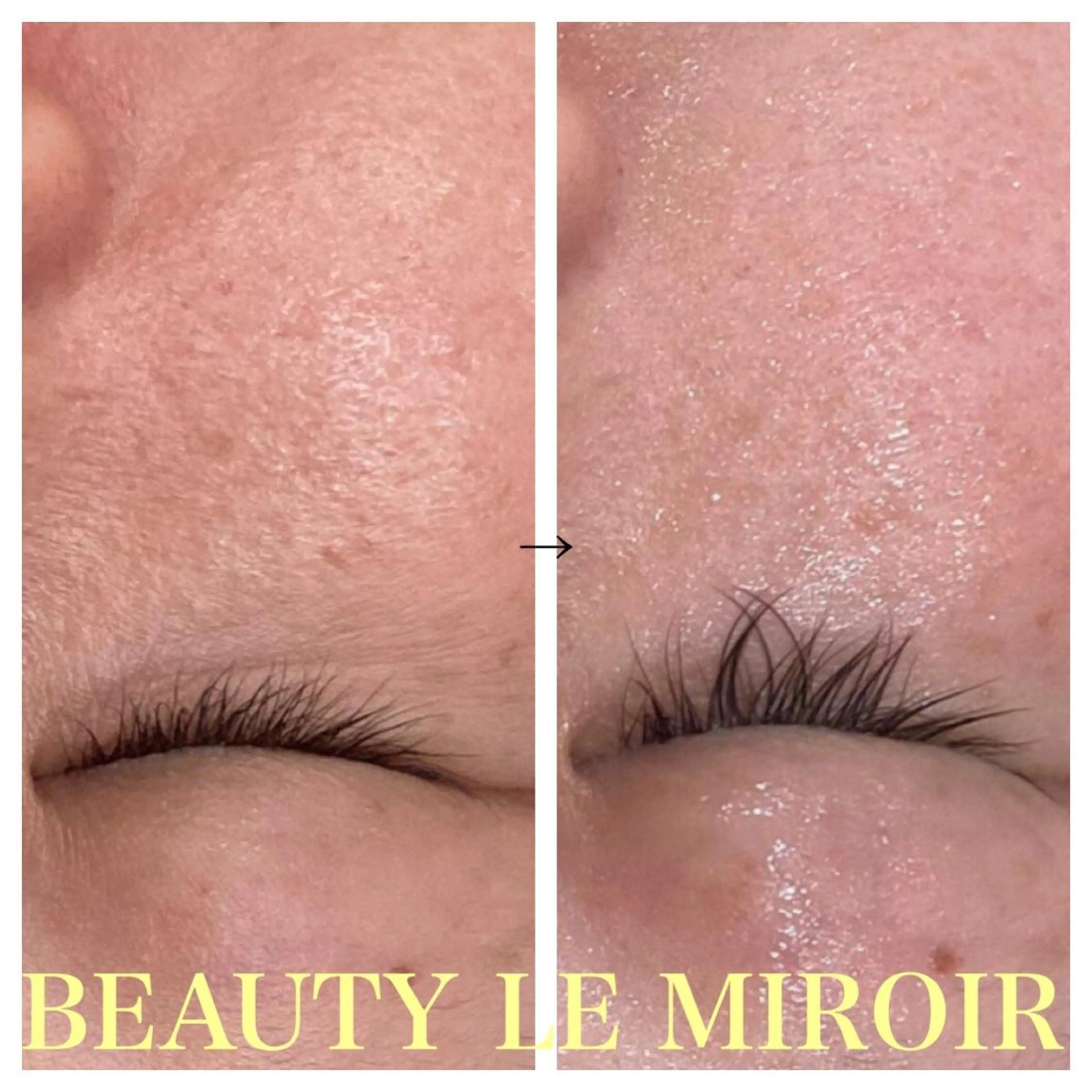 ビューティー ミロワールのエステ・リラクイメージ