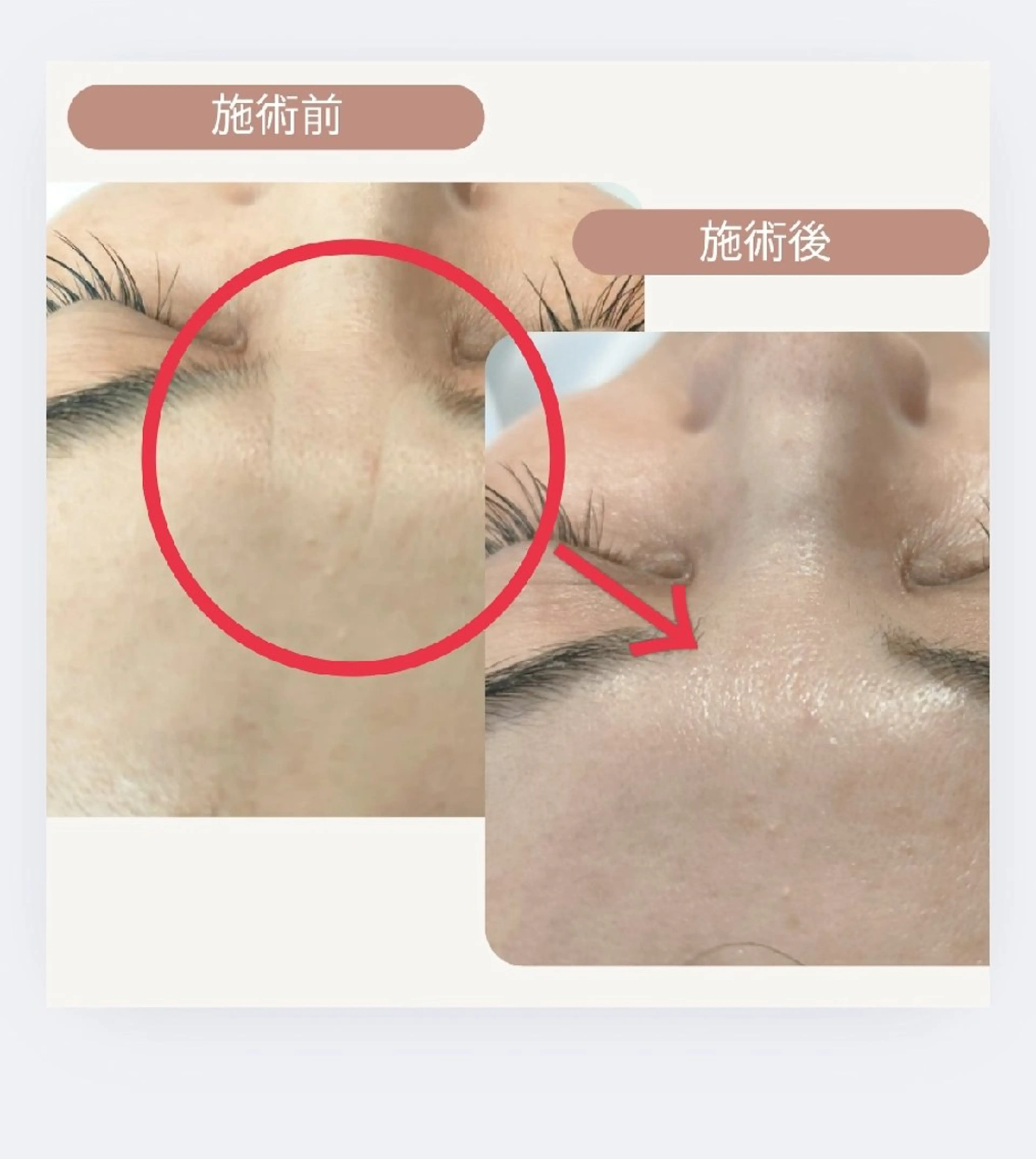 cocojujur バリ式リンパ＆美肌のエステ・リラクイメージ