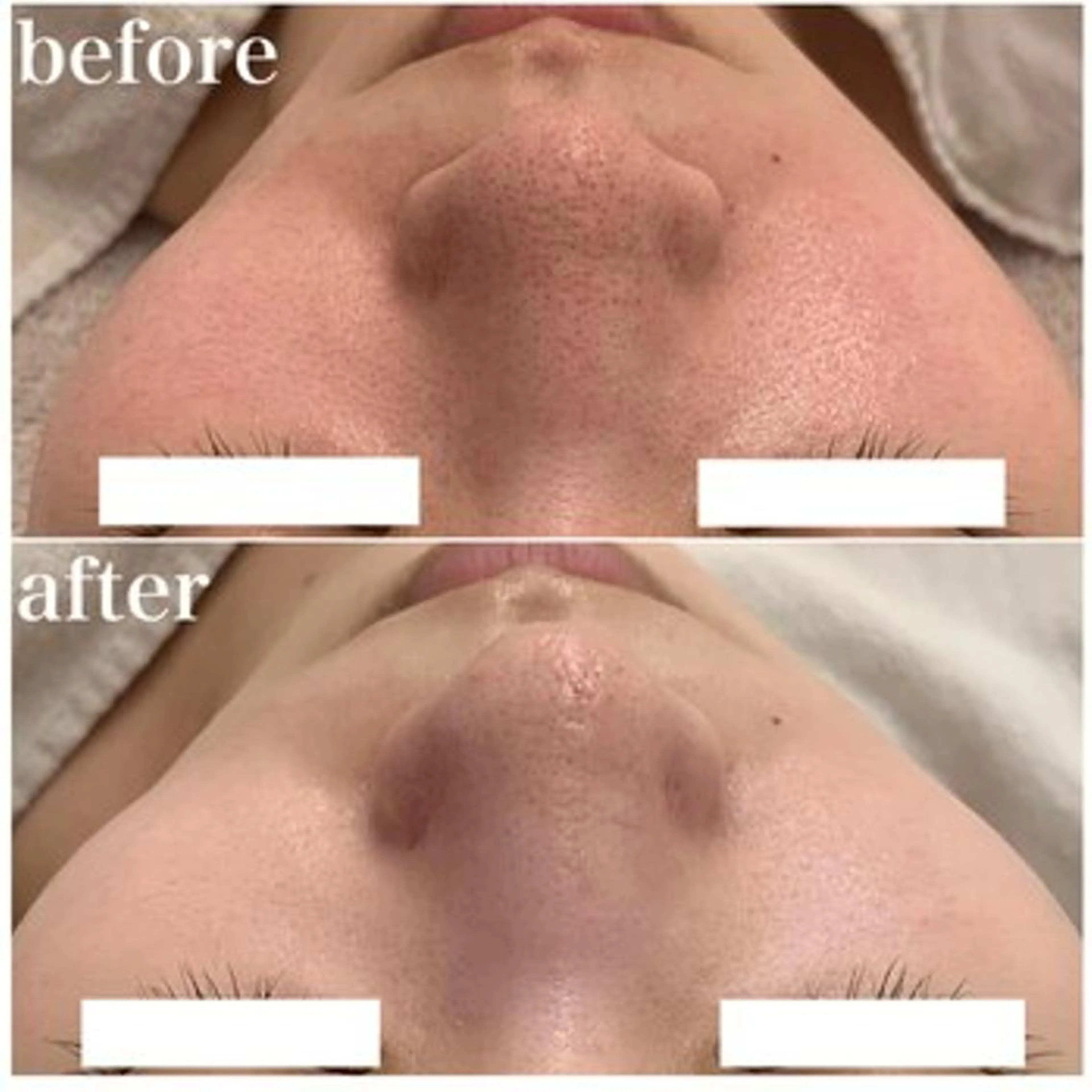 ✨美肌水光✨ アトリエリュバンのエステ・リラクイメージ