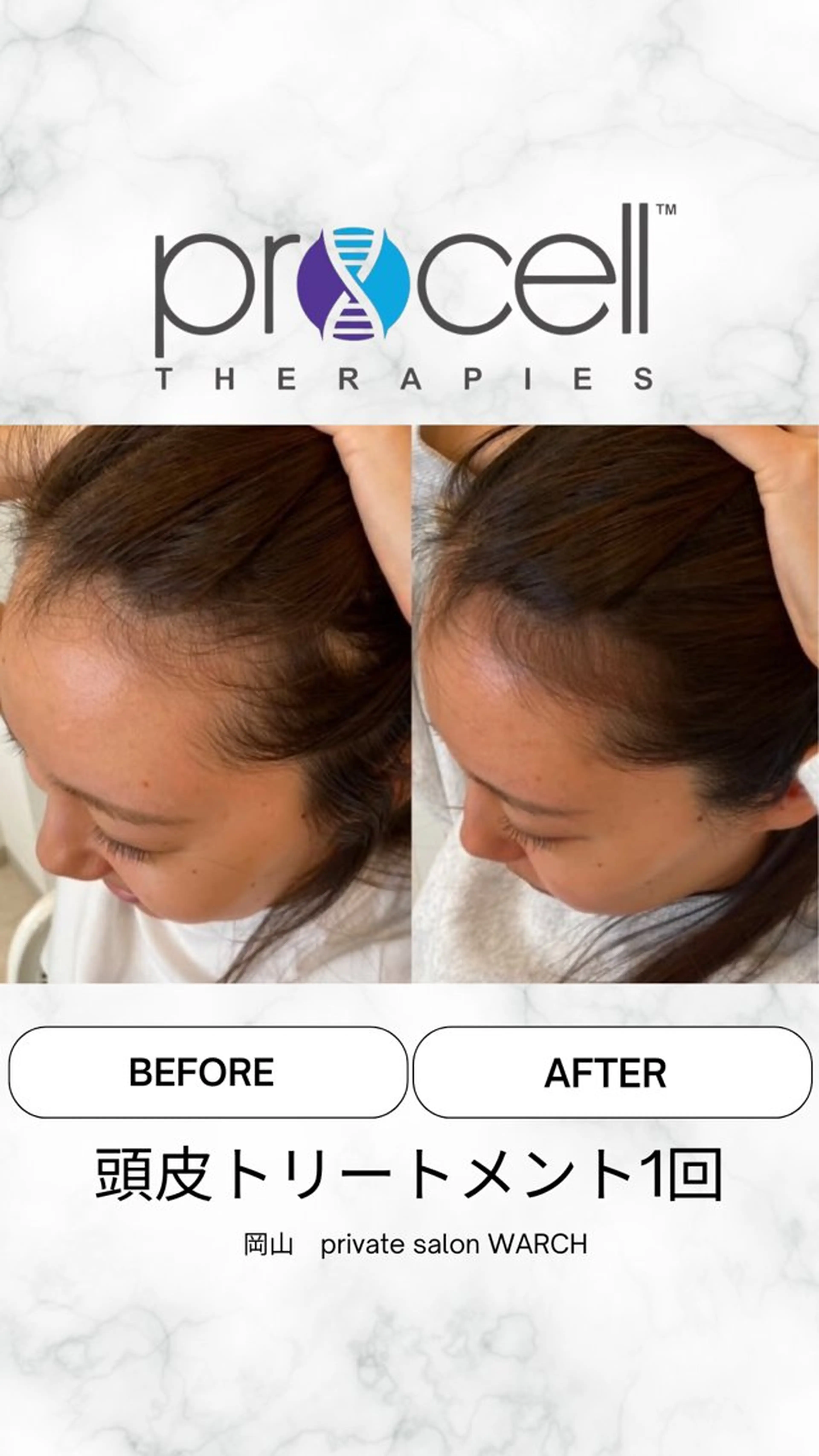 WARCH Marieのその他イメージ