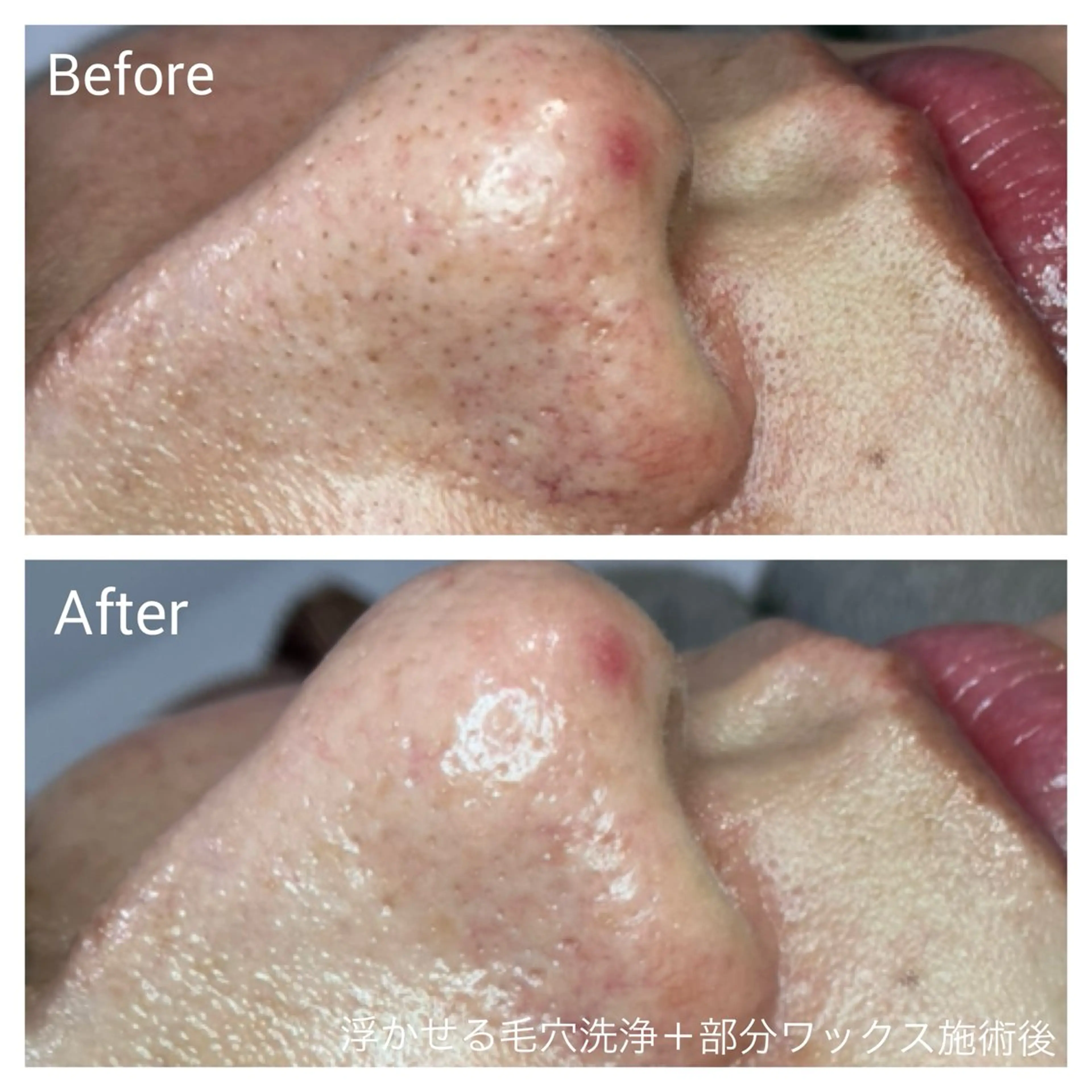 エステ リラク 深い肌悩み専門 フェイシャルサロンのエステ・リラクイメージ