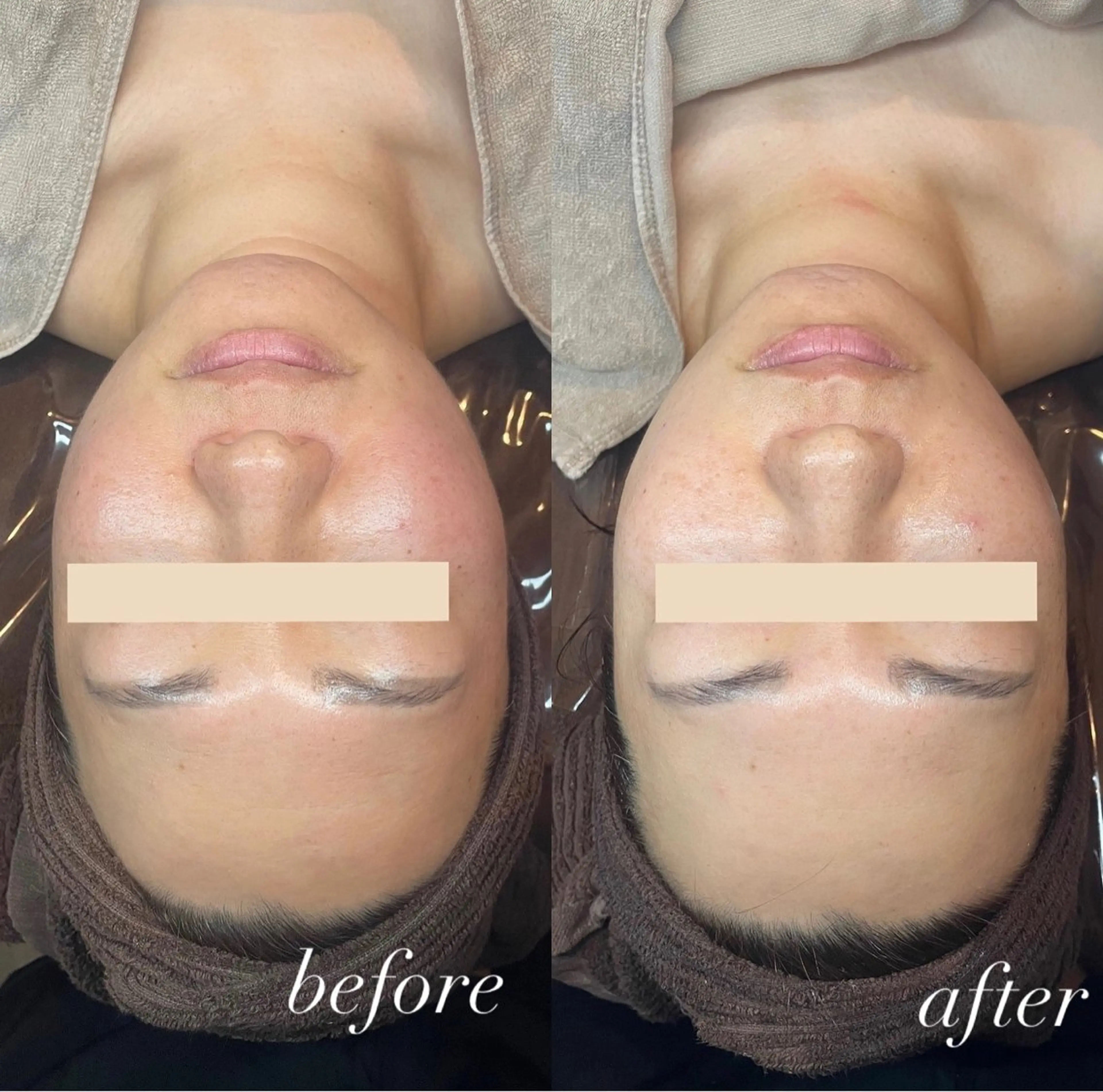 エステ 吉井 奈緒美のマツエク・マツパデザイン