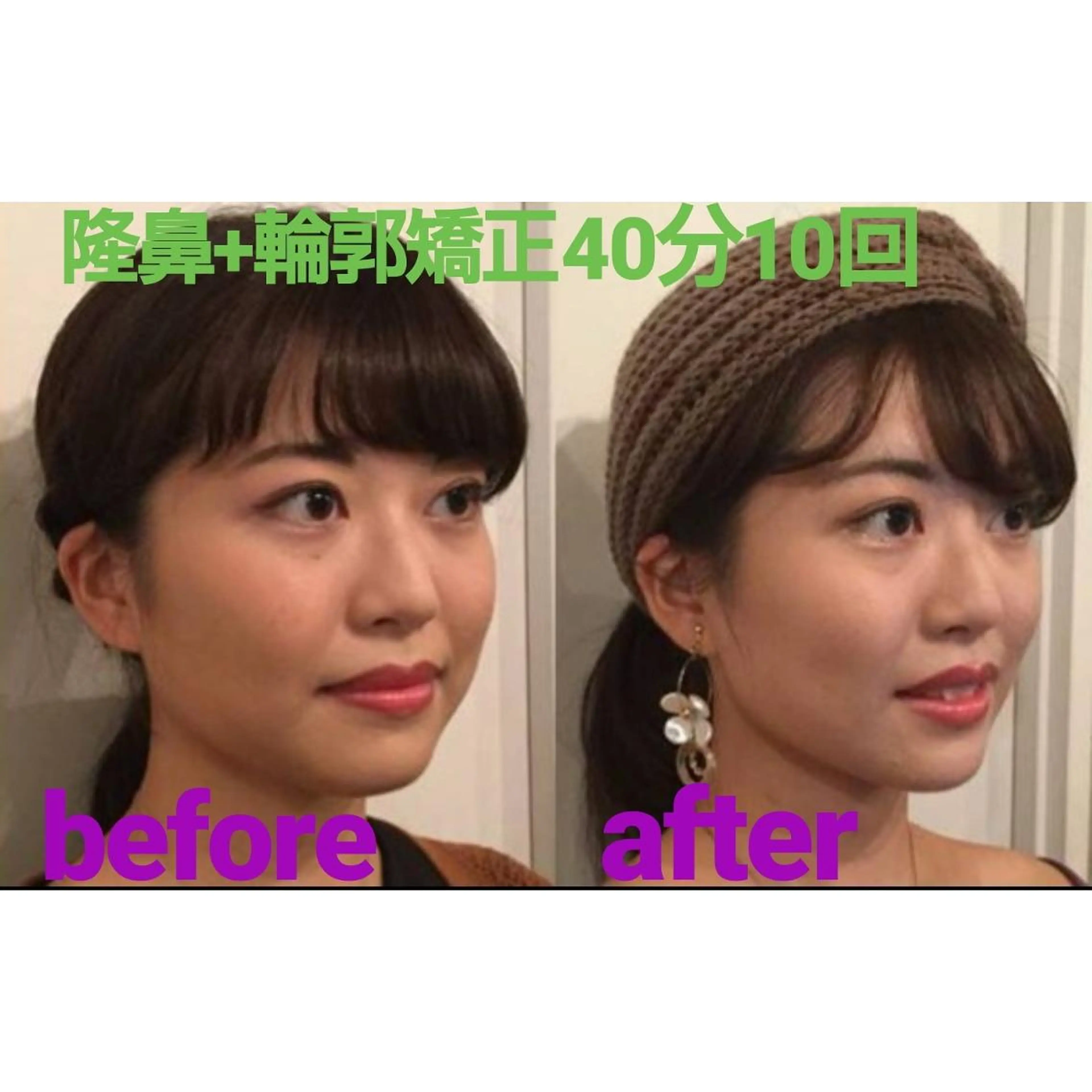 エステ リラク 隆鼻矯正専門店ラプリ 古越のエステ・リラクイメージ